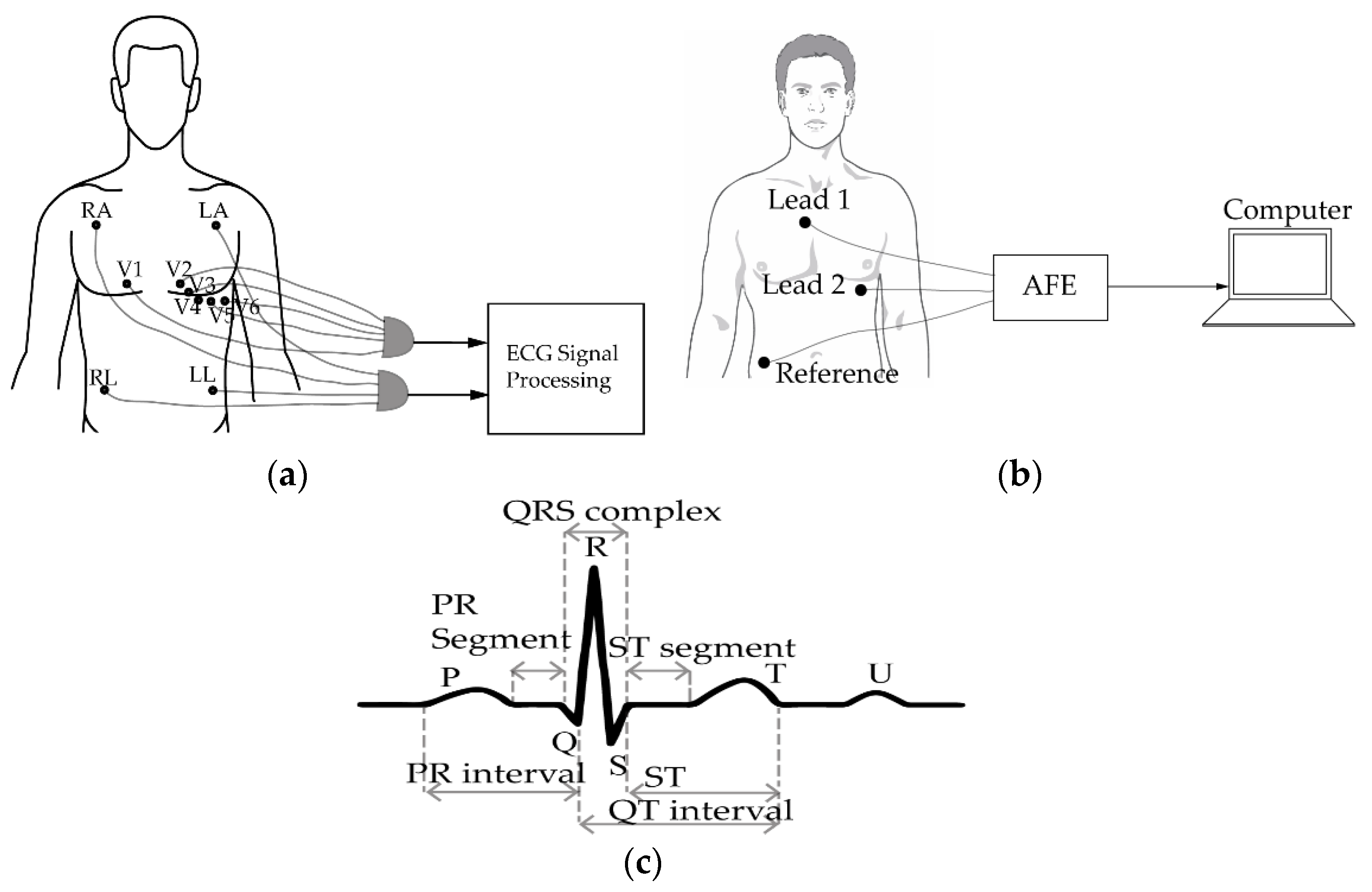 Sensors 20 01454 g001