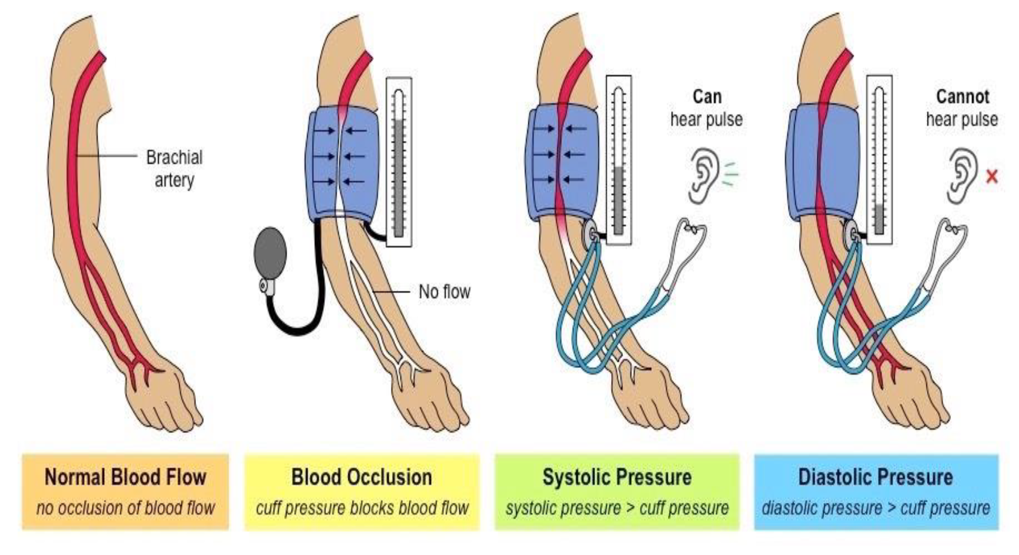 Sensors 20 01454 g007