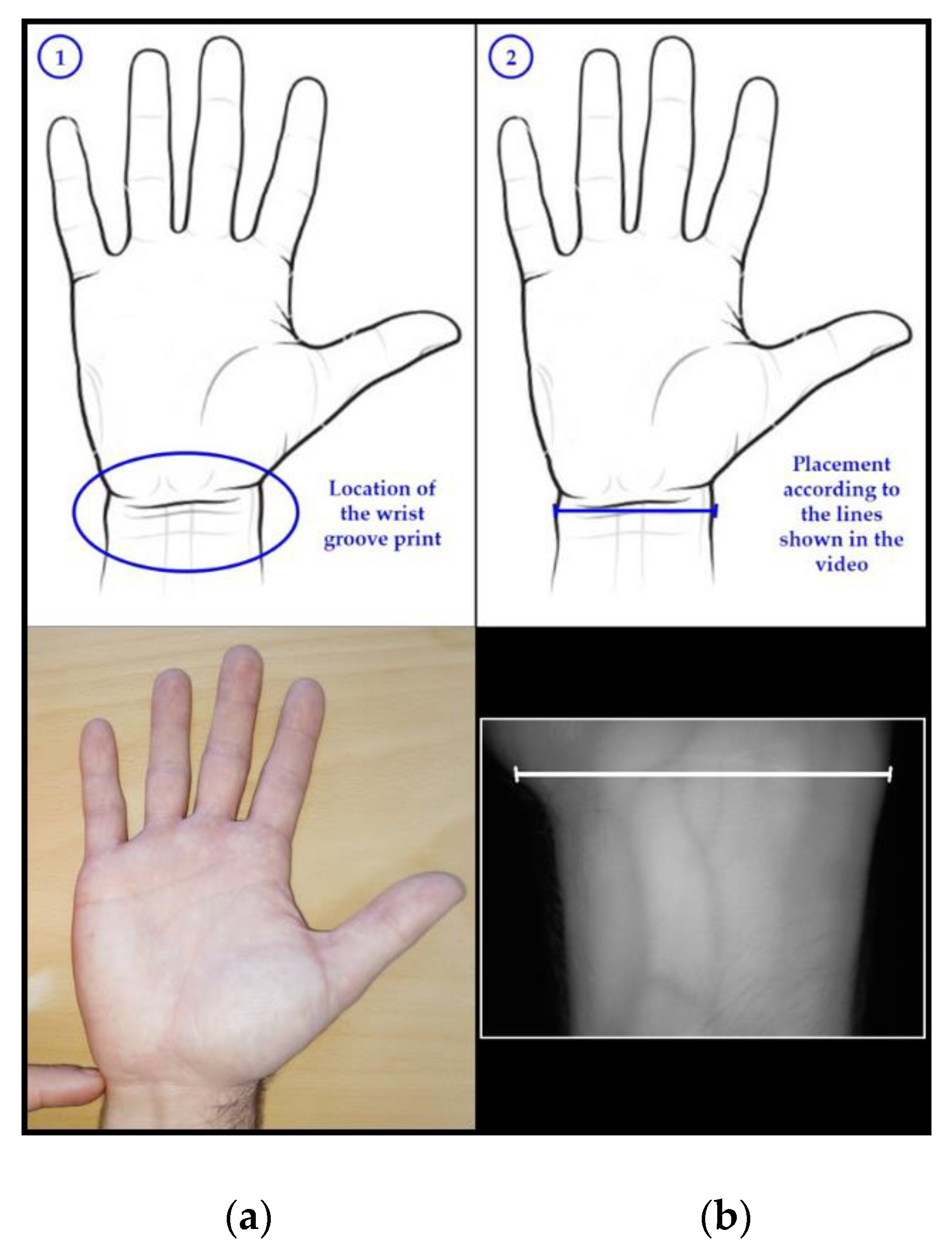 Sensors 20 01469 g002 Sensors 20 01469 g002