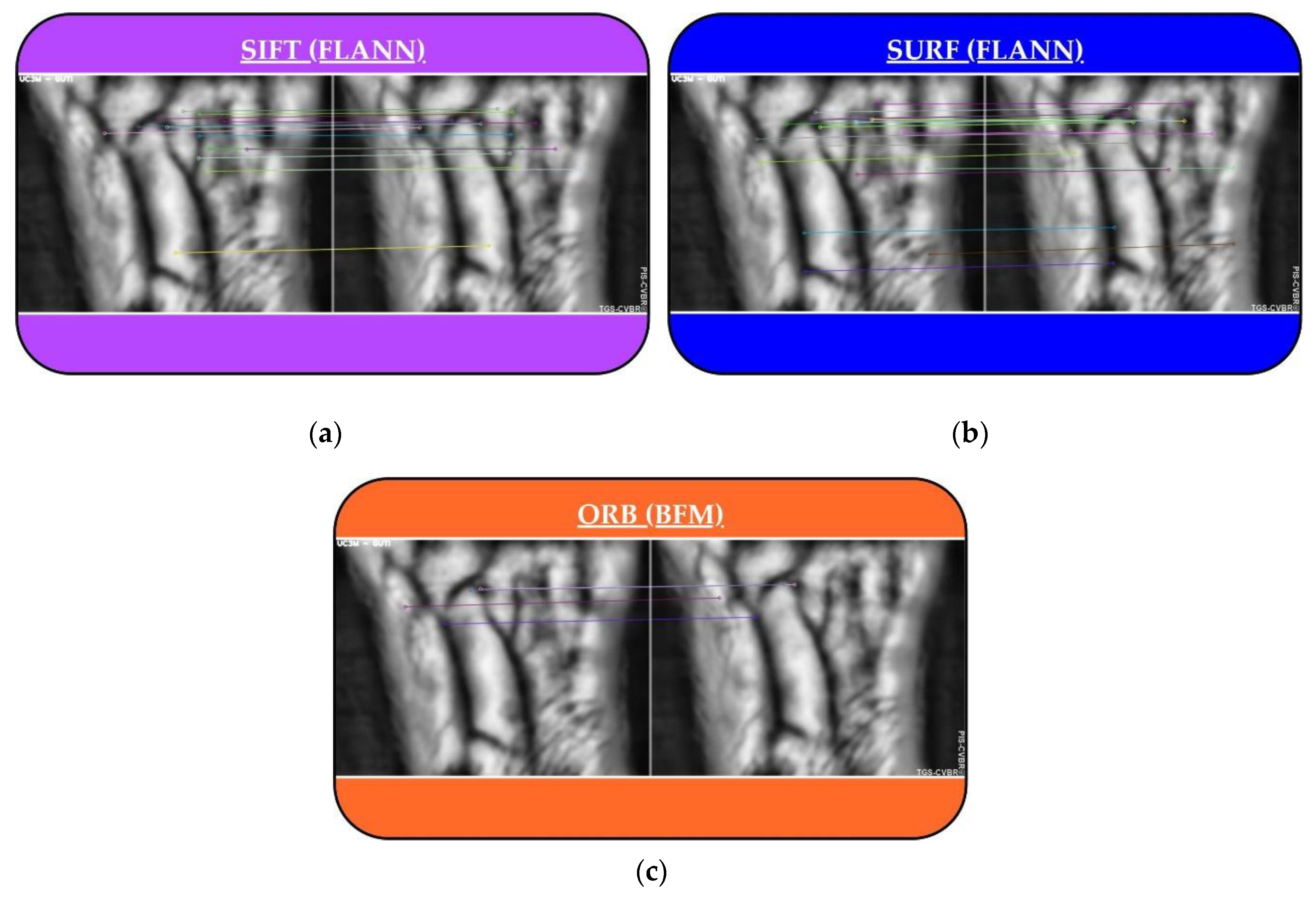 Sensors 20 01469 g005 Sensors 20 01469 g005