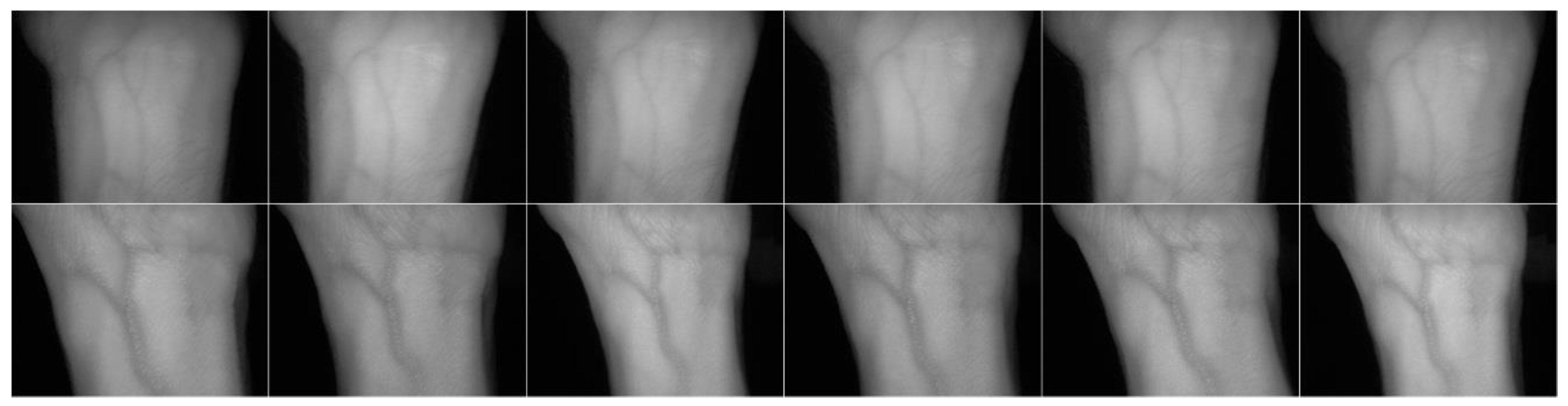 Sensors 20 01469 g011 Sensors 20 01469 g011