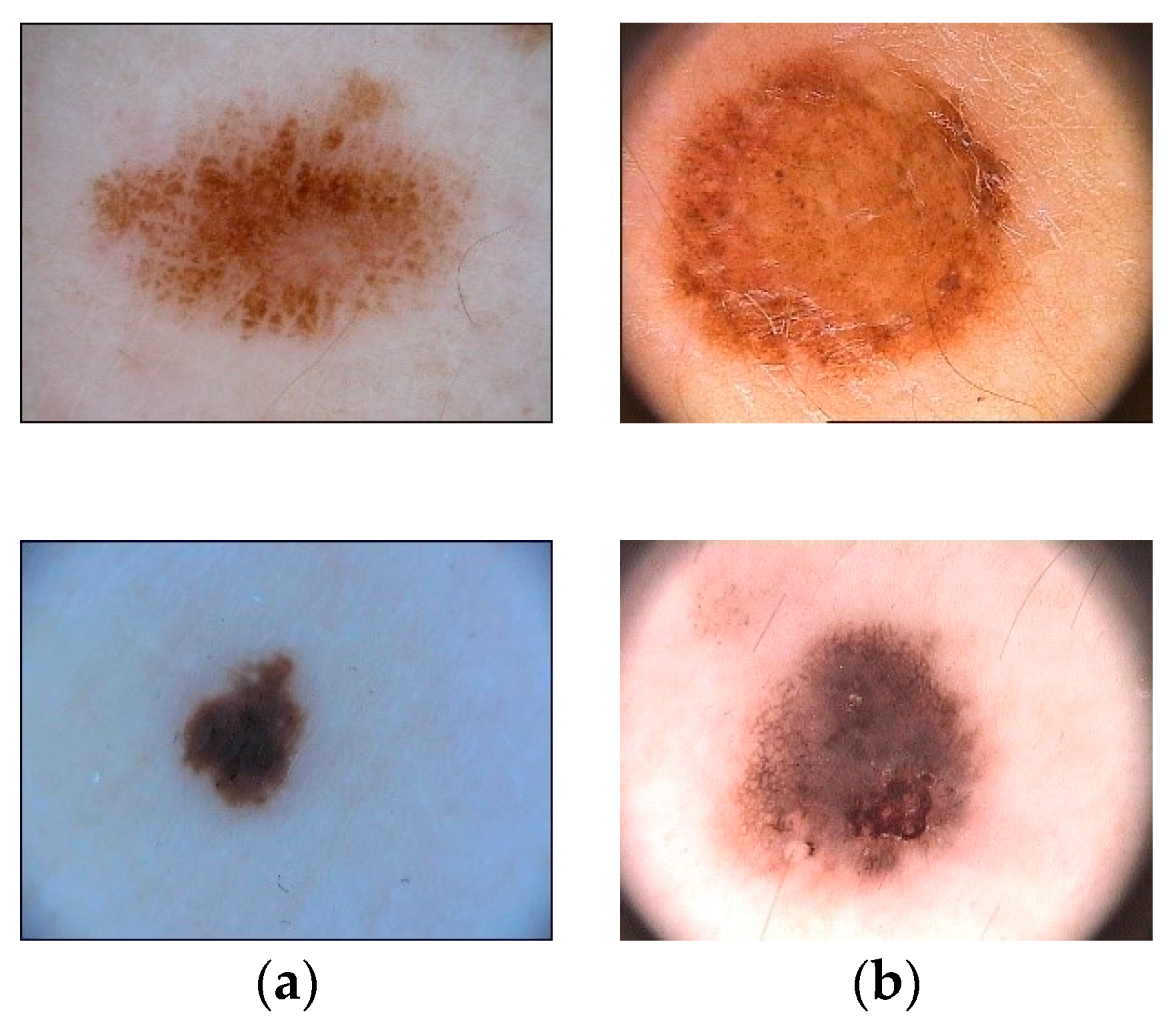 Sensors 20 01601 g001