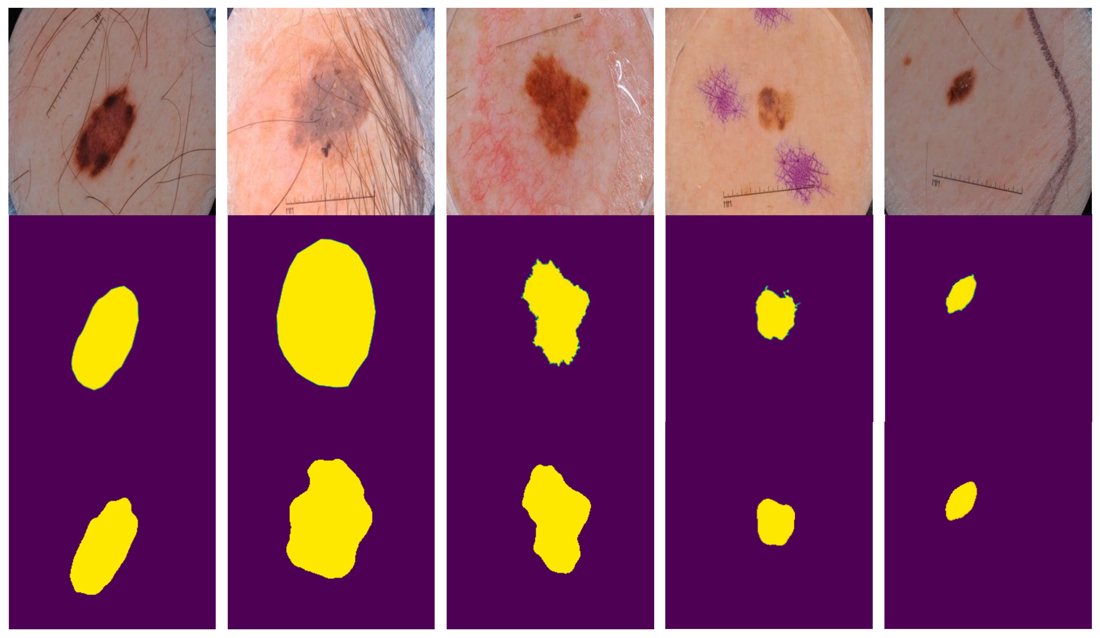 Sensors 20 01601 g005