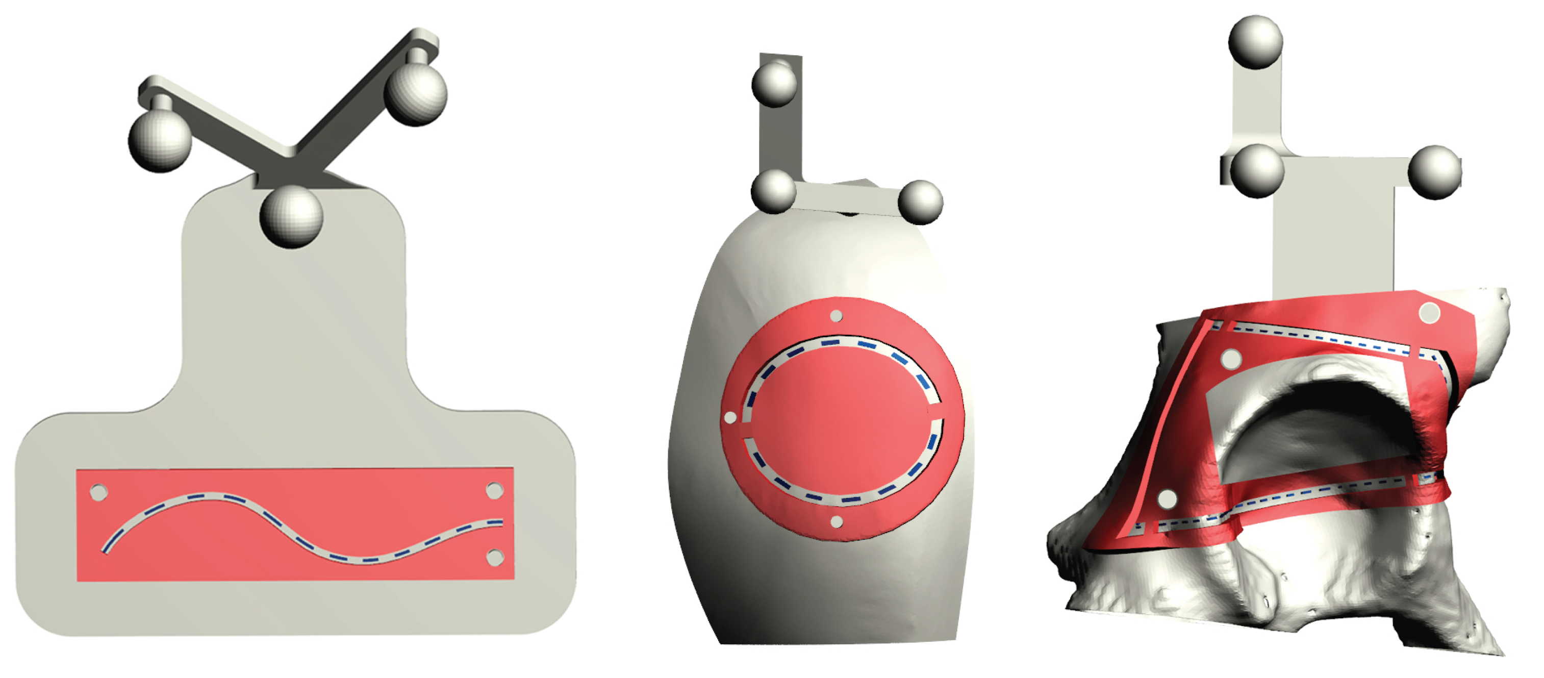 Sensors 20 01612 g004