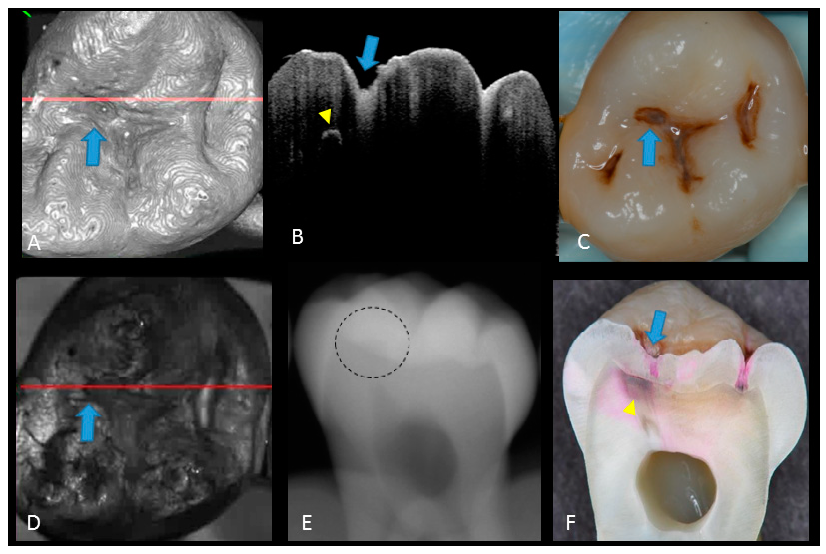 Sensors 20 01659 g006