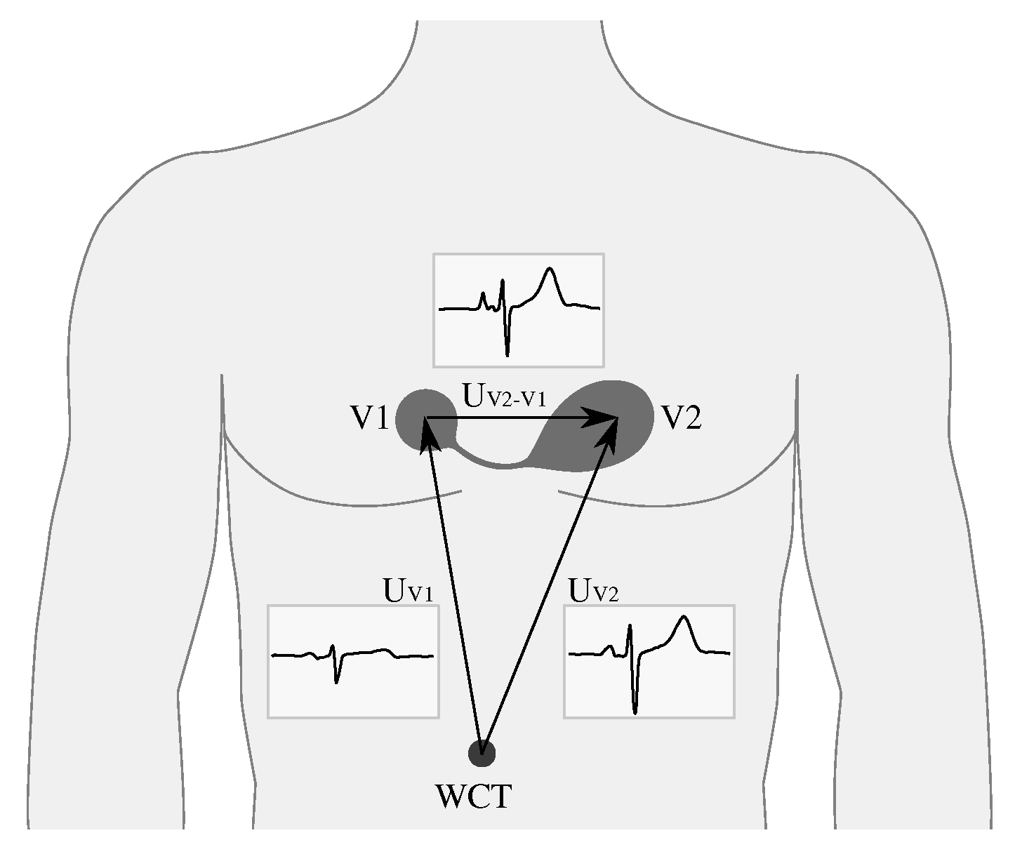 Sensors 20 01695 g001