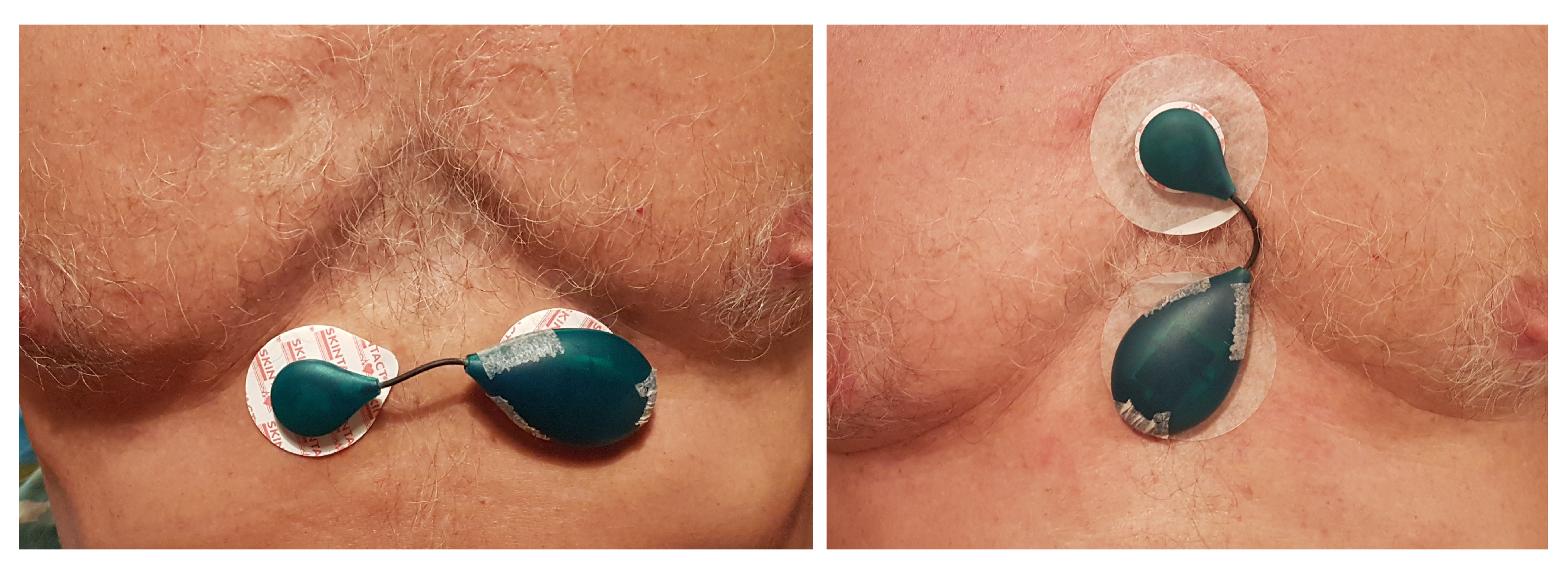 Sensors 20 01695 g006