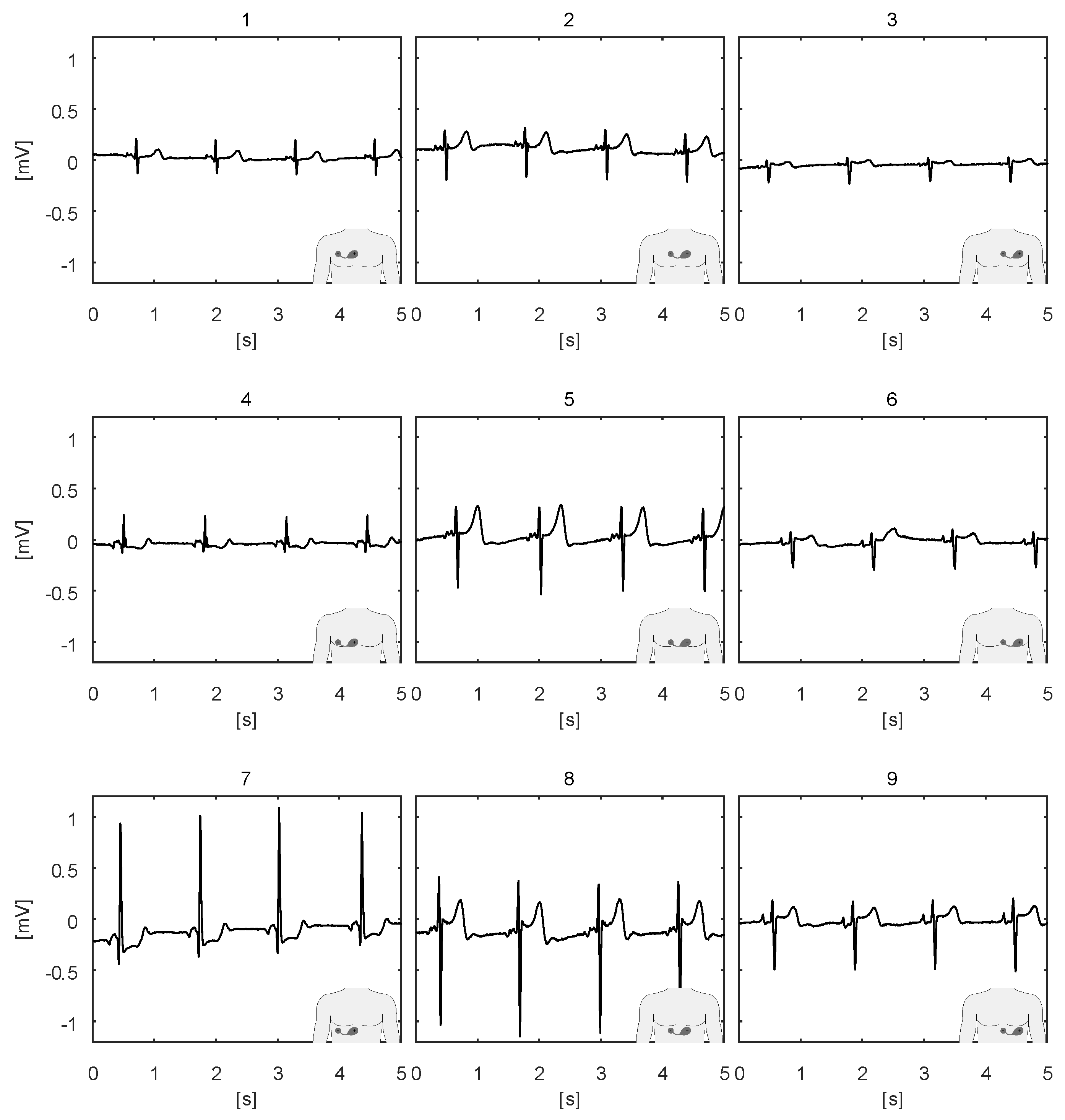 Sensors 20 01695 g007