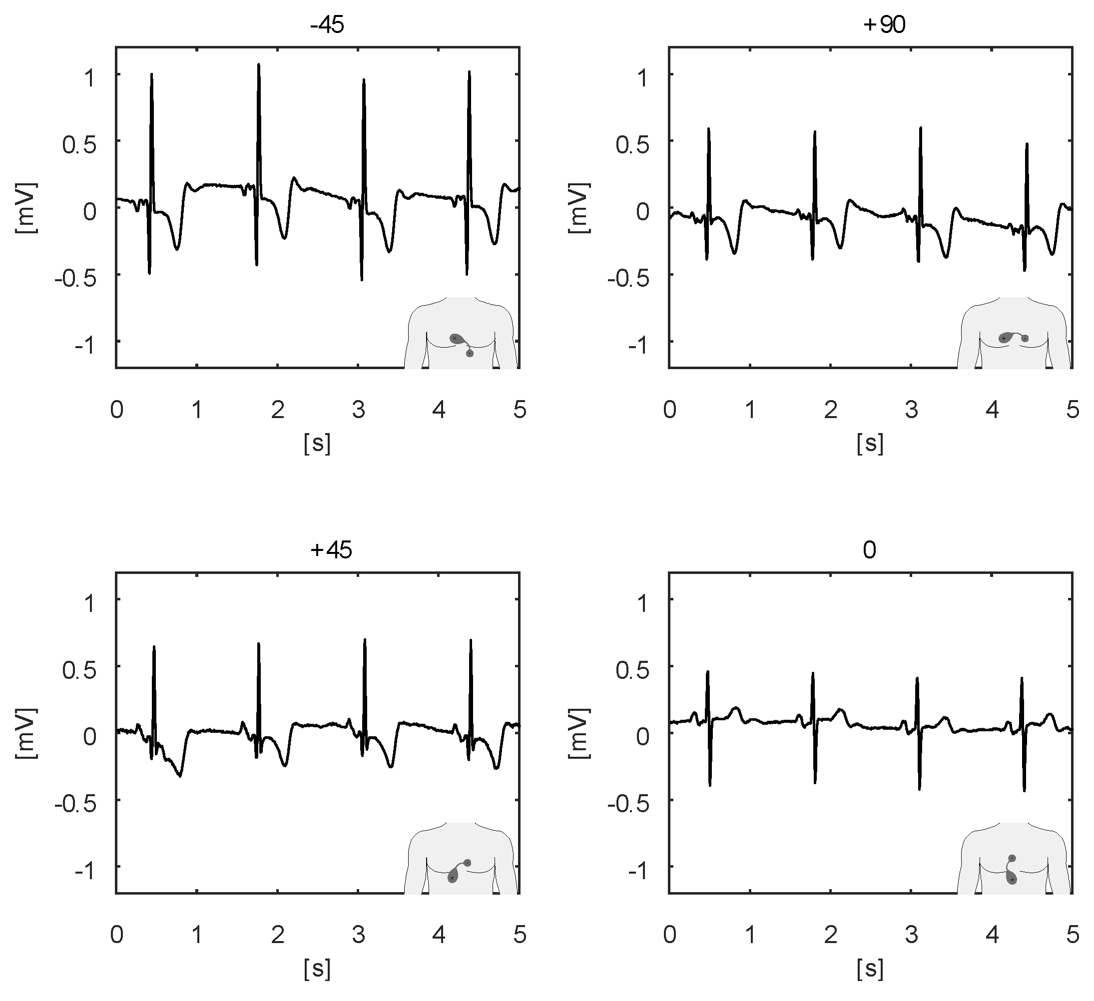 Sensors 20 01695 g008
