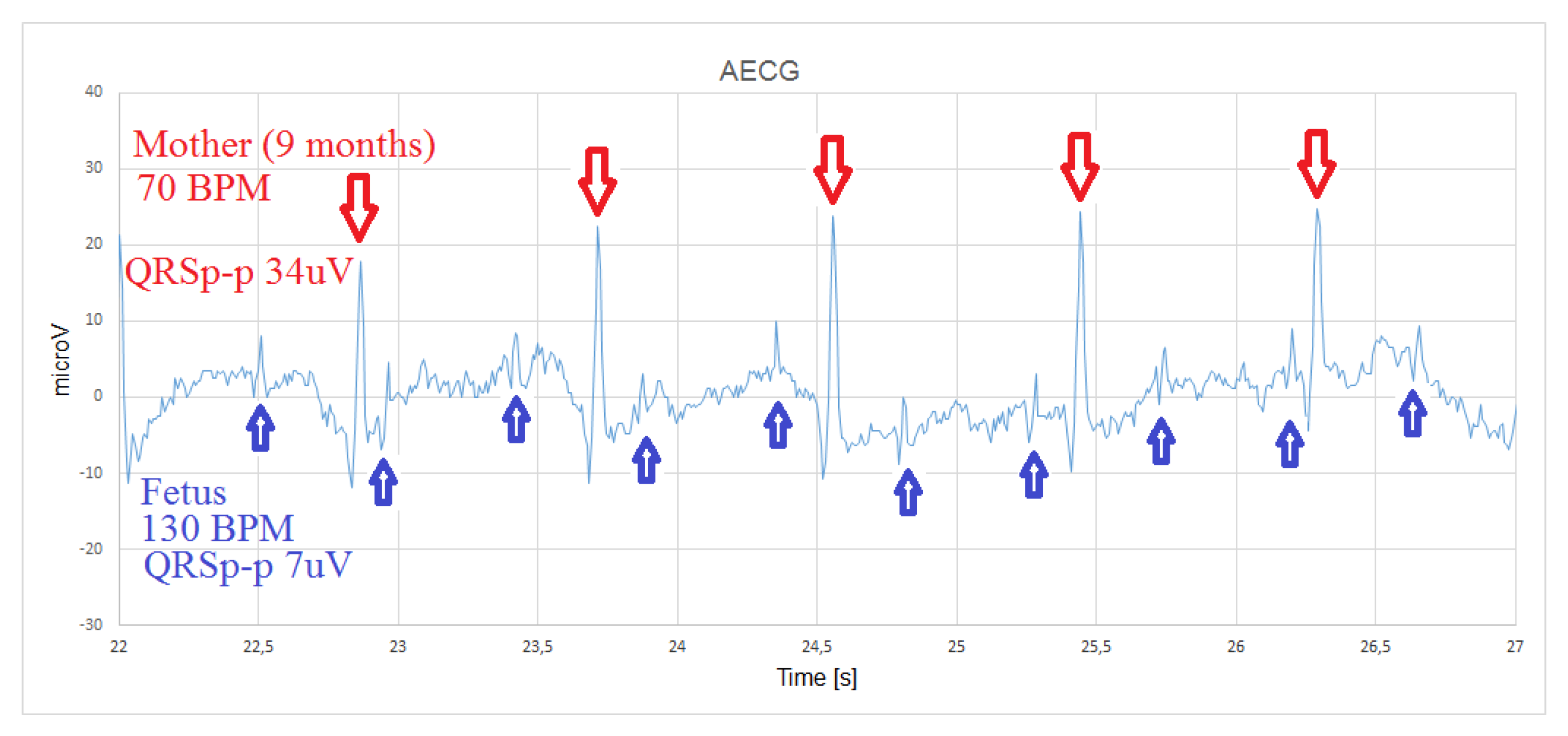 Sensors 20 01695 g010