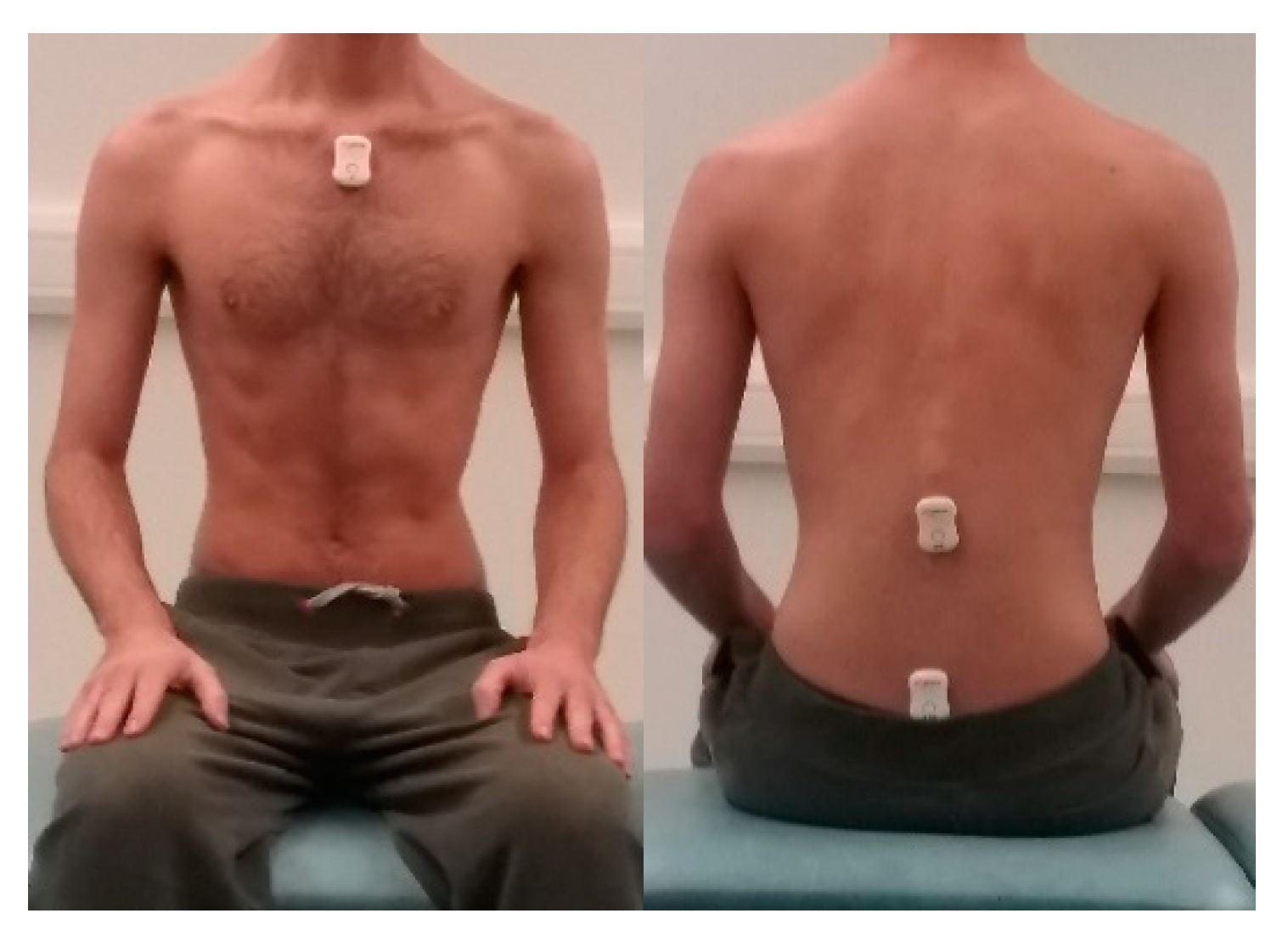 Sensors 20 01699 g001