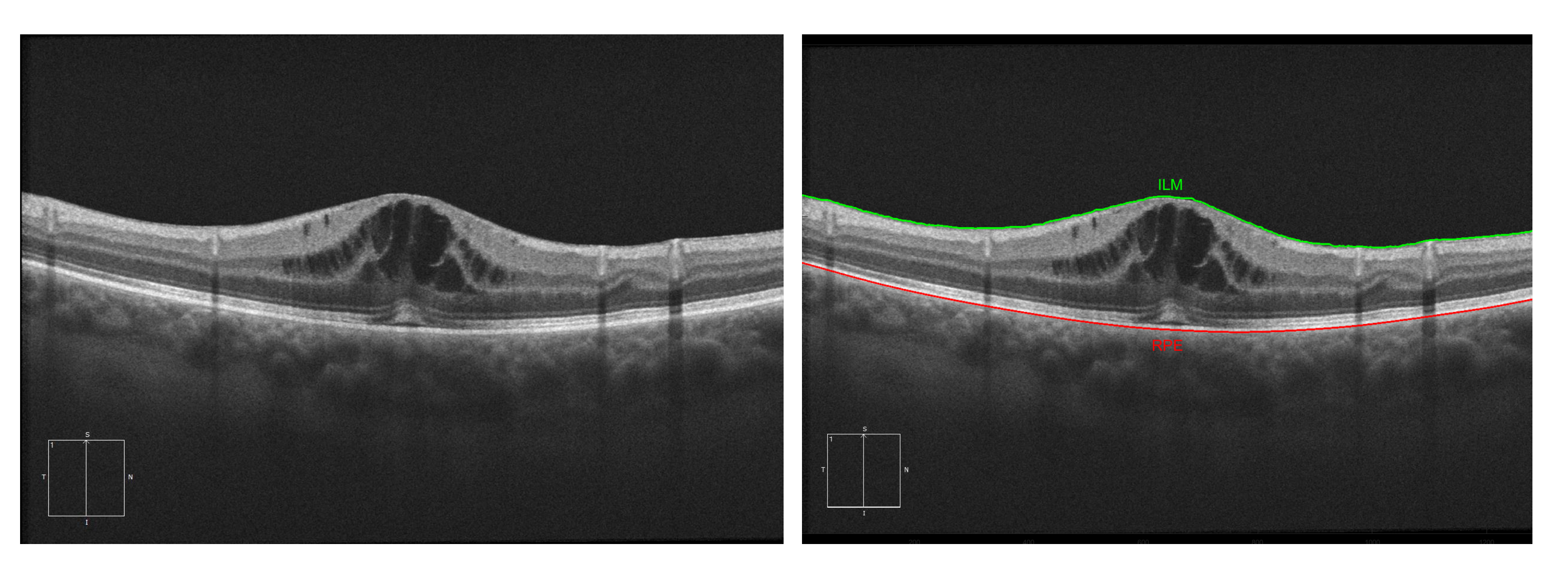 Sensors 20 02004 g005