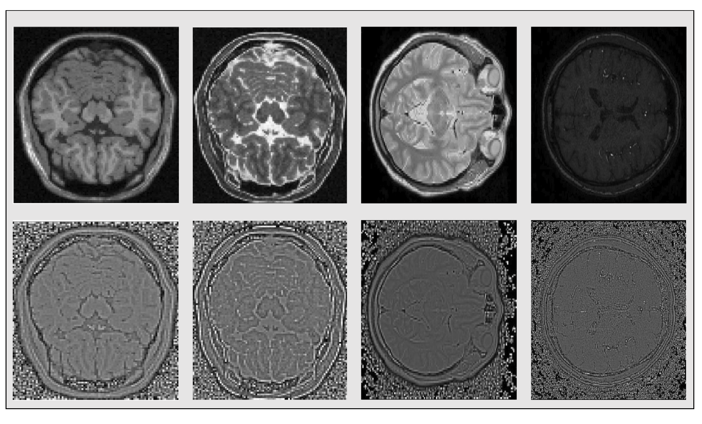 Sensors 20 02325 g003