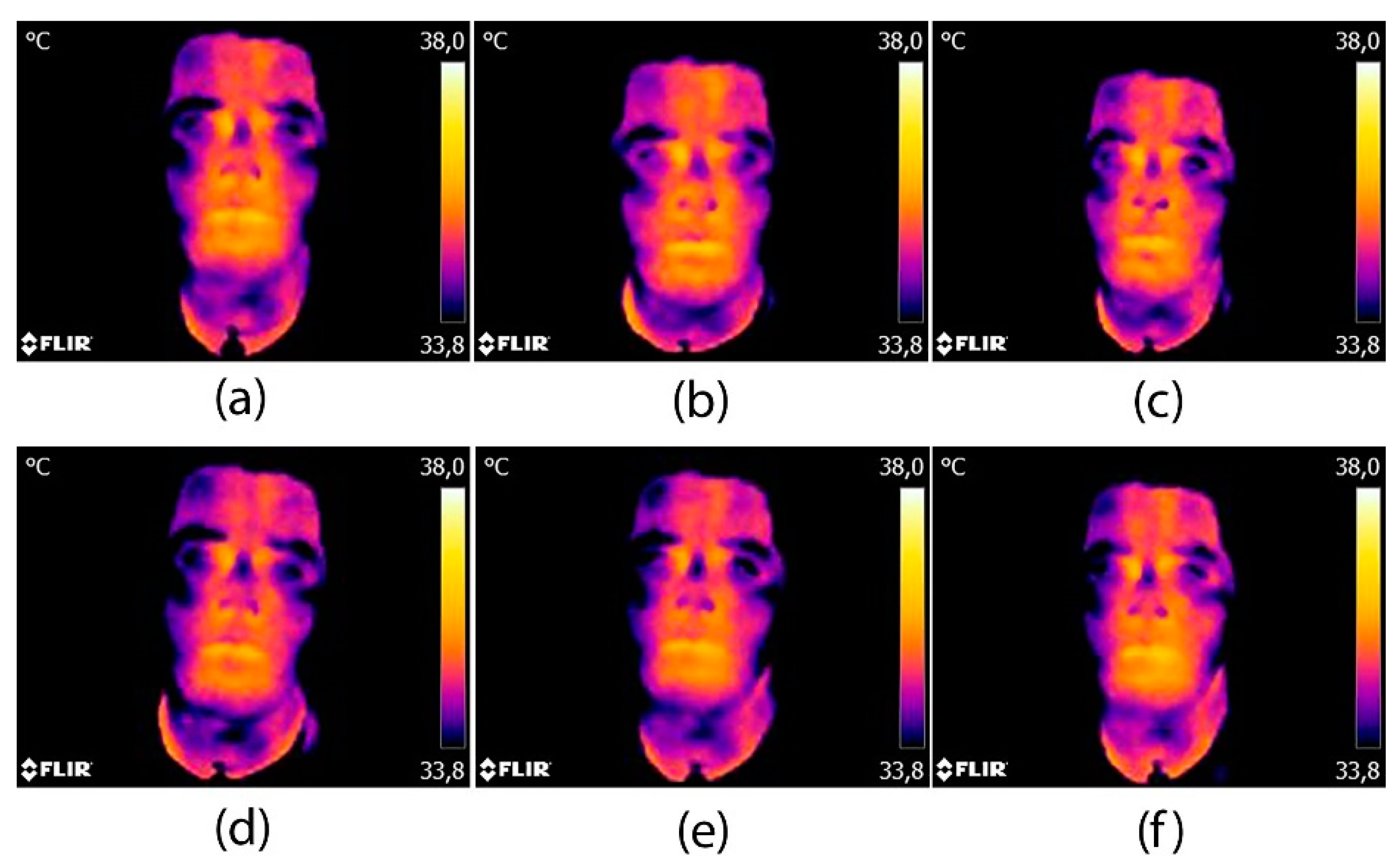 Sensors 20 02502 g007