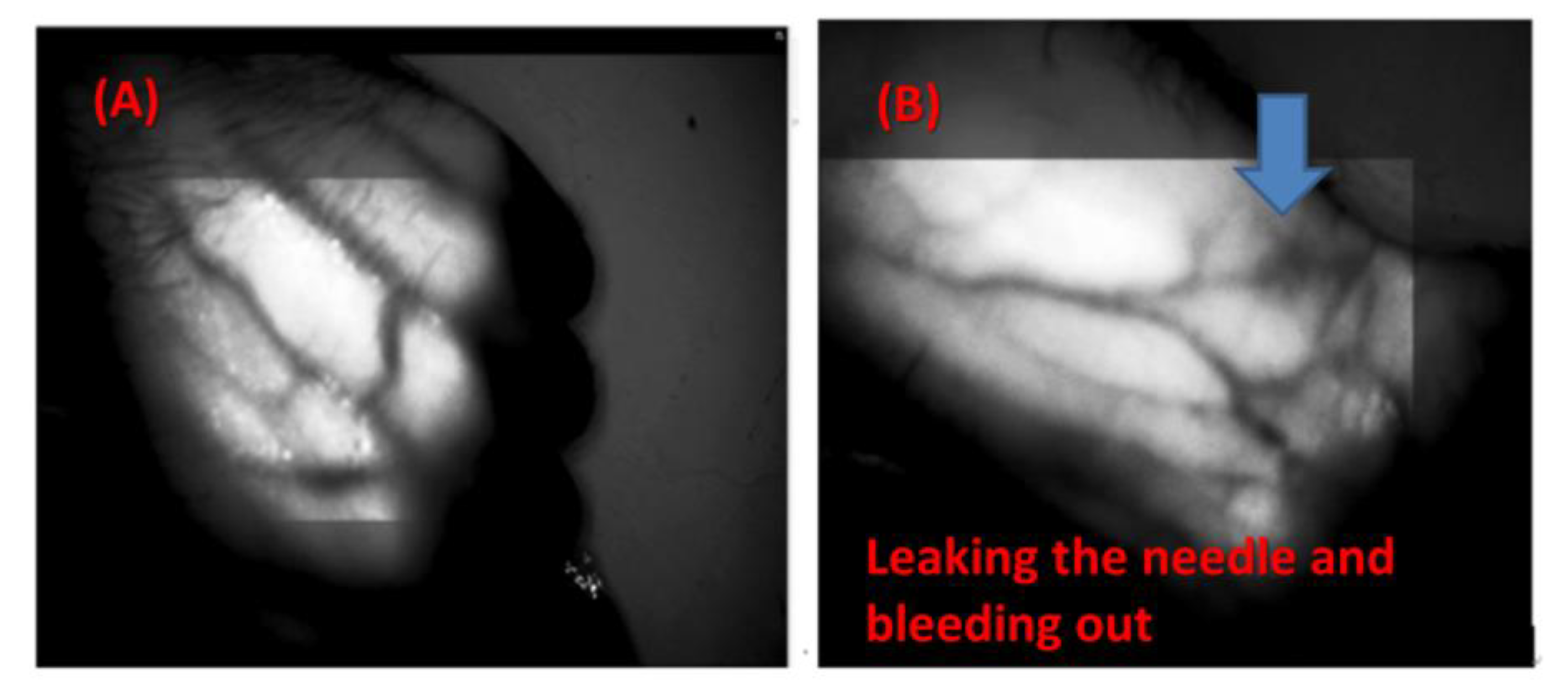 Sensors 20 02521 g009a