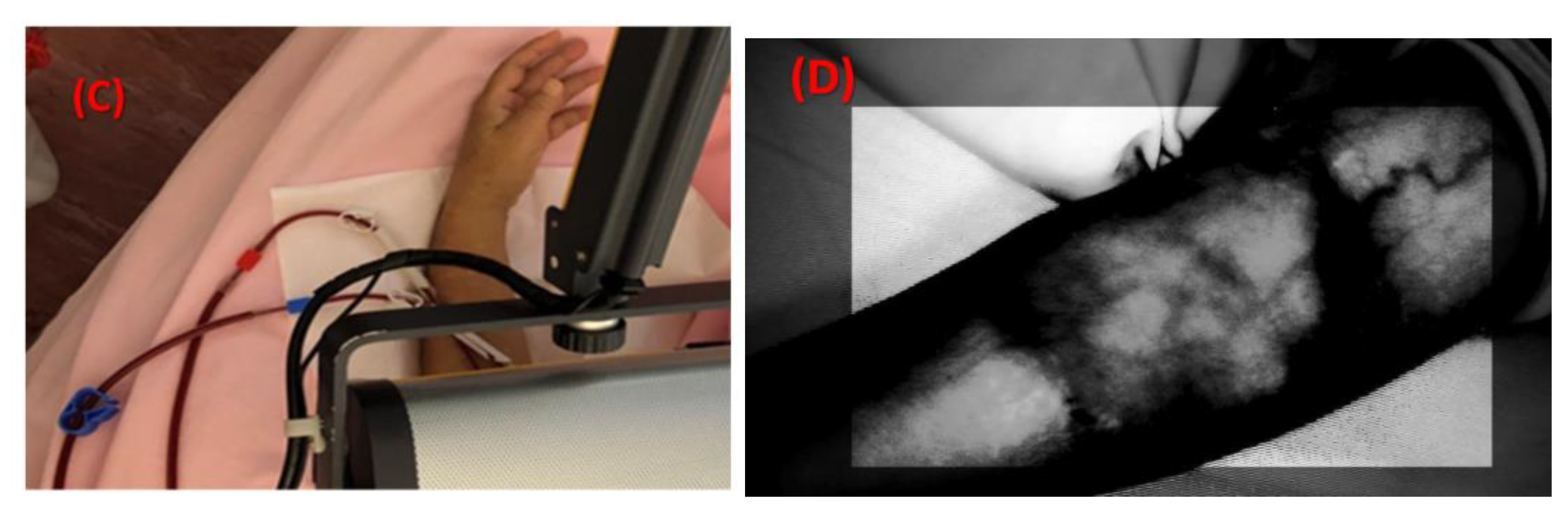 Sensors 20 02521 g009b