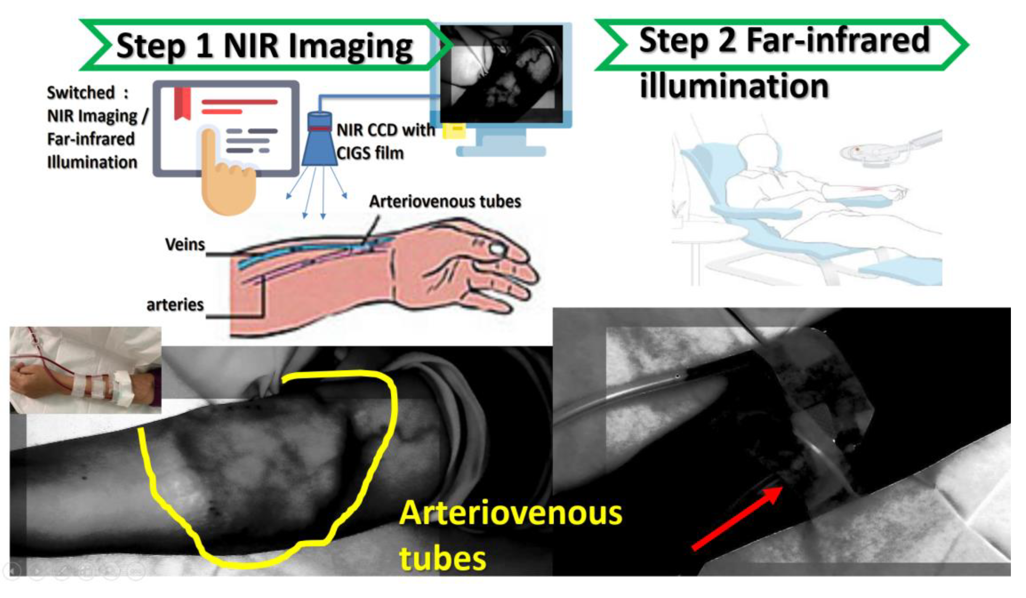 Sensors 20 02521 g011