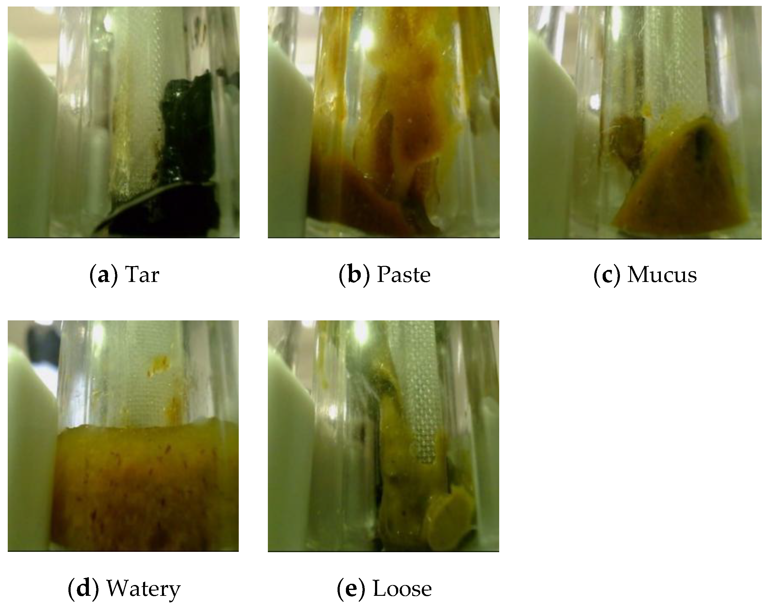 Sensors 20 02644 g001