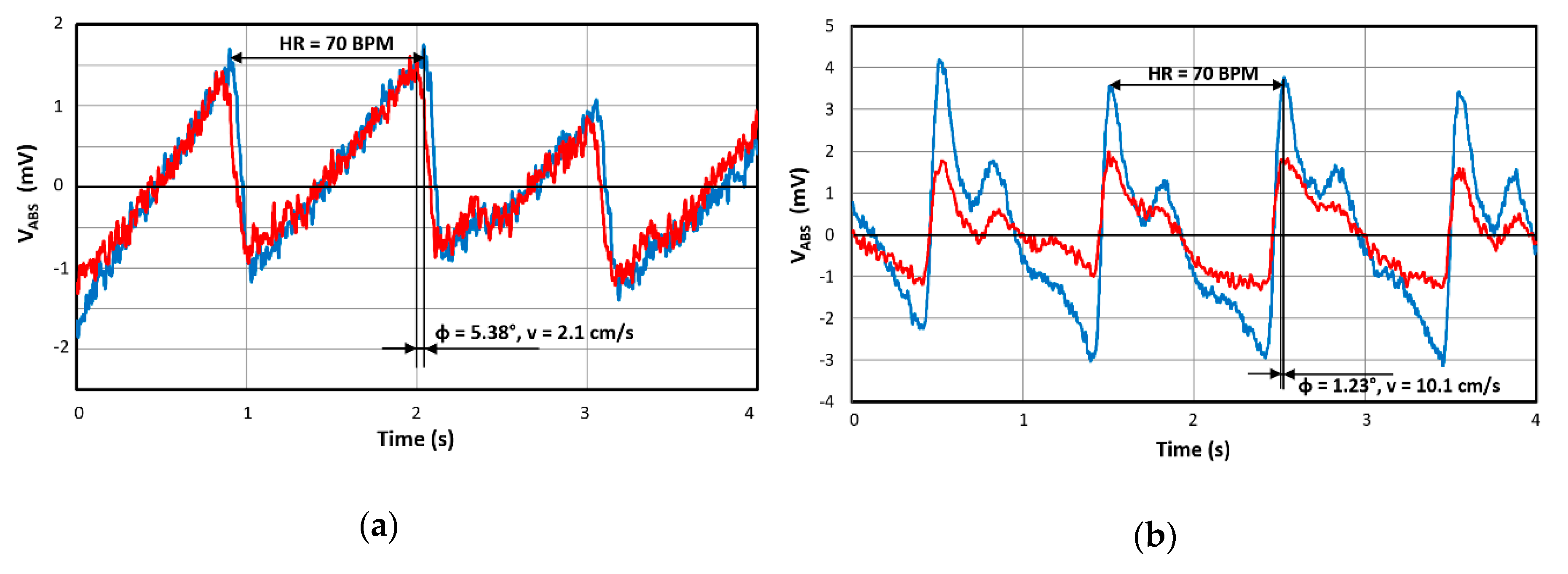 Sensors 20 02663 g011