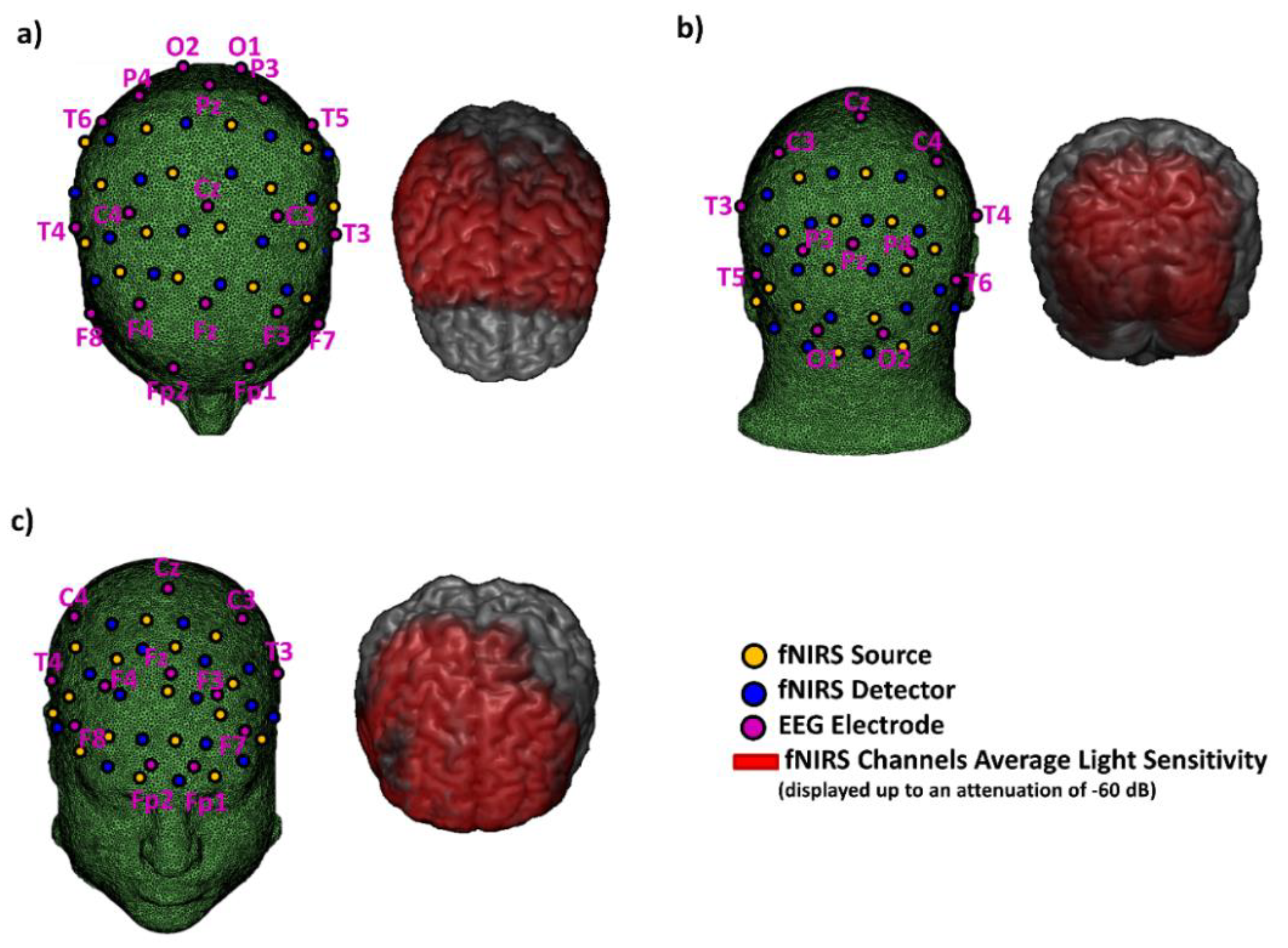 Sensors 20 02831 g004