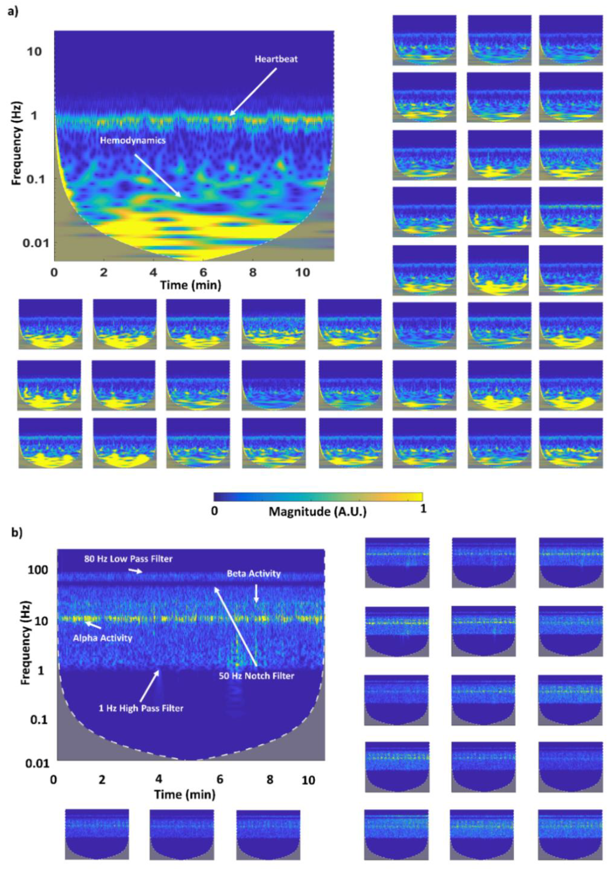 Sensors 20 02831 g007