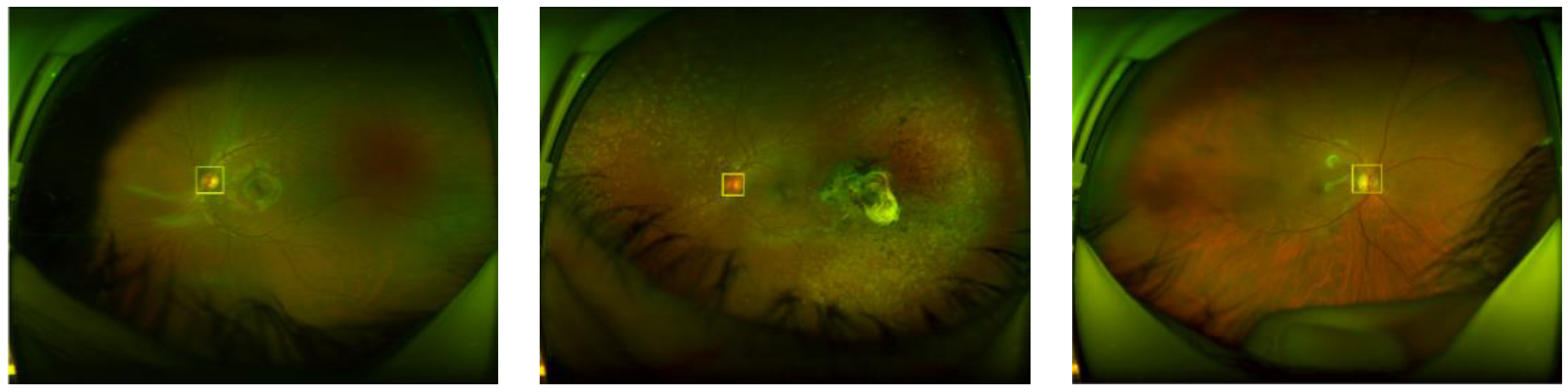 Sensors 20 02838 g004 Sensors 20 02838 g004