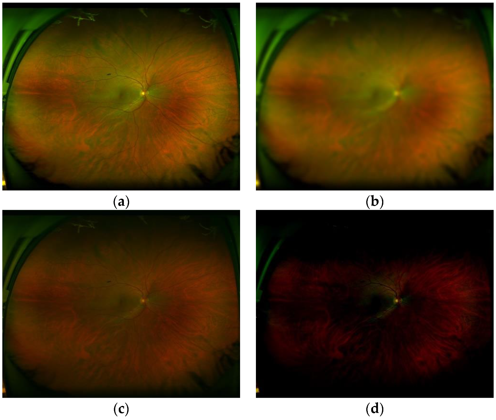Sensors 20 02838 g015 Sensors 20 02838 g015