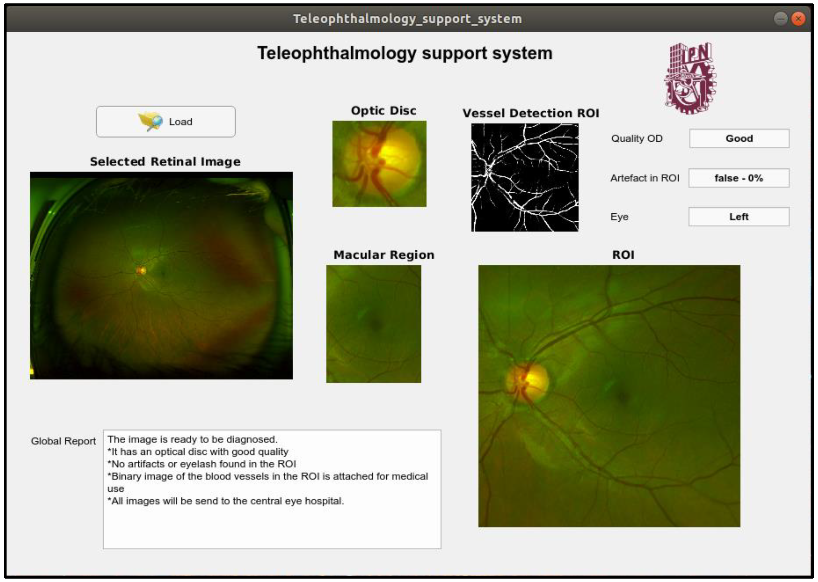 Sensors 20 02838 g016 Sensors 20 02838 g016