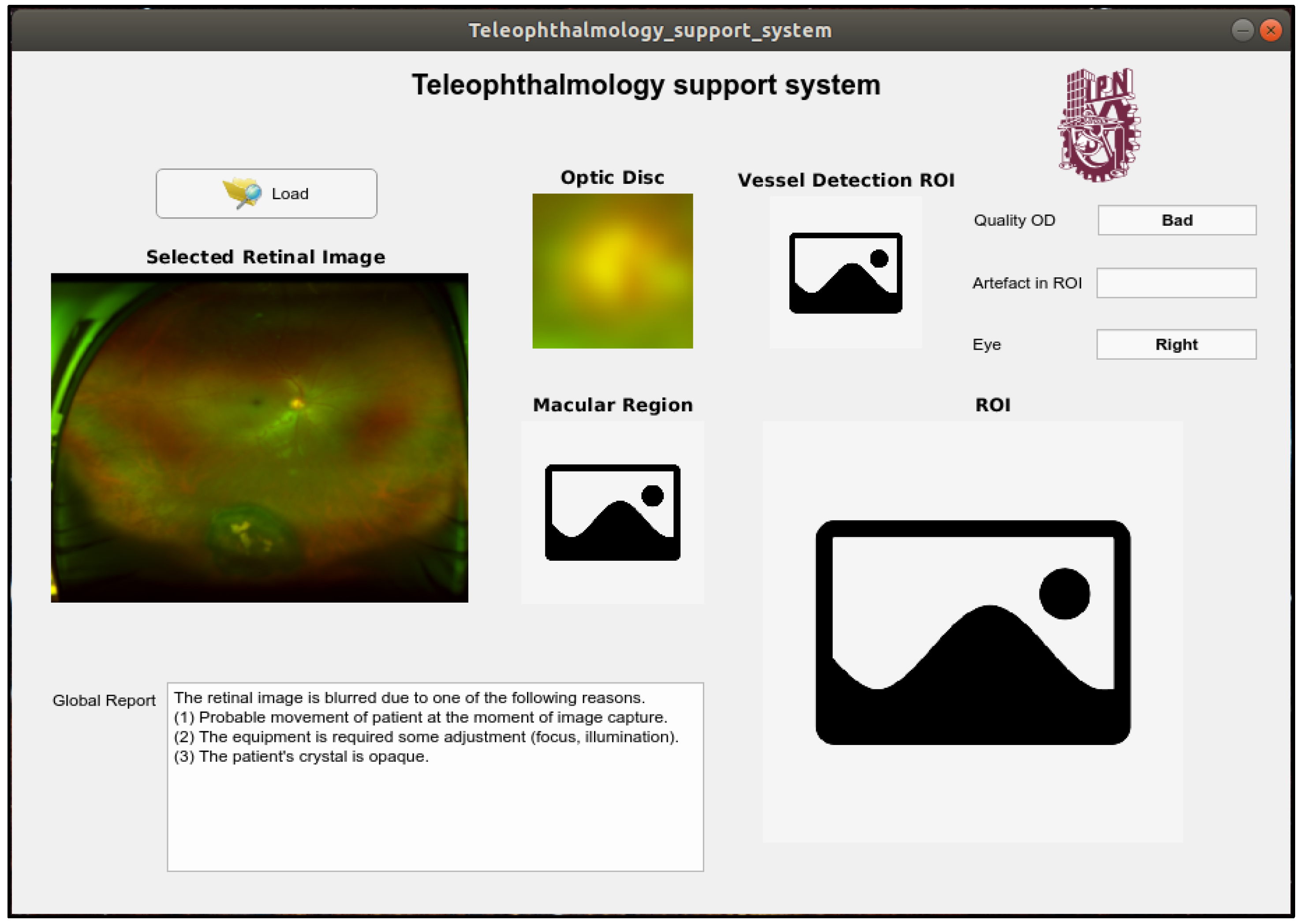 Sensors 20 02838 g017 Sensors 20 02838 g017