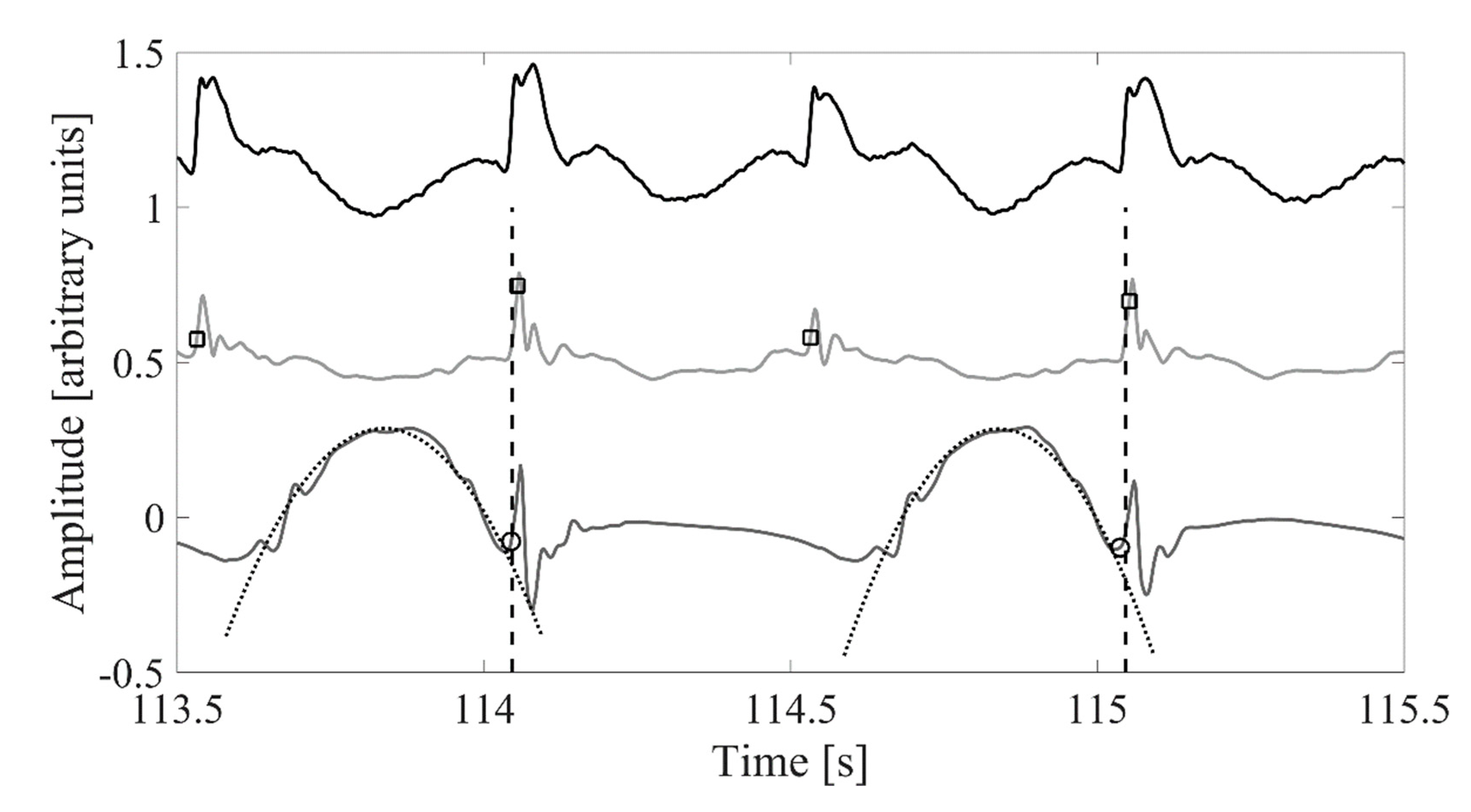 Sensors 20 02858 g001
