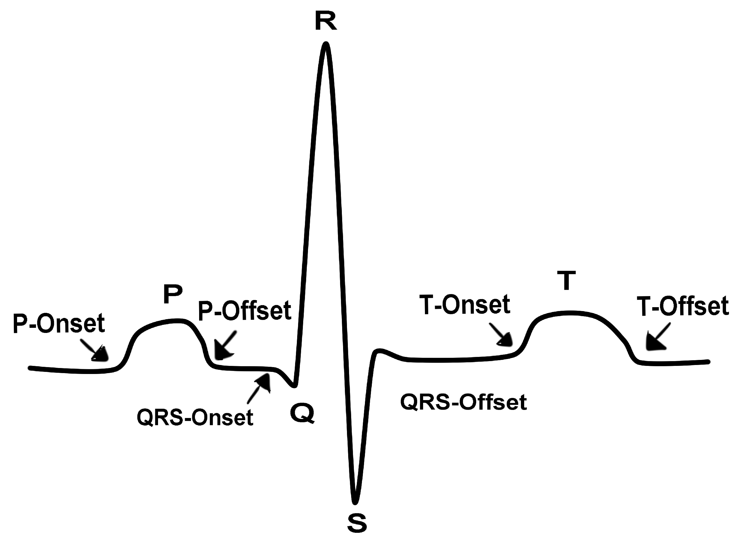 Sensors 20 02920 g003