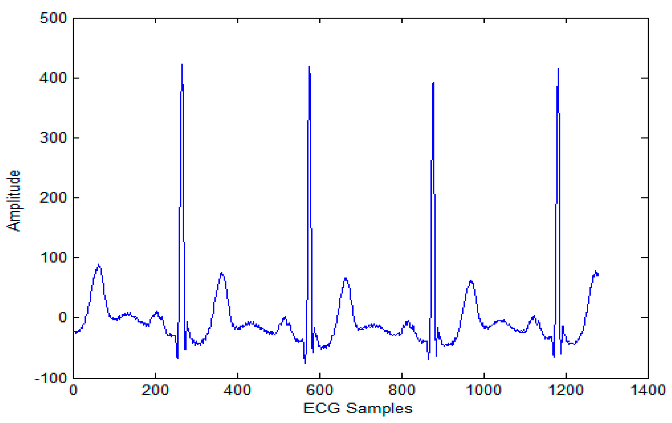Sensors 20 02941 g001