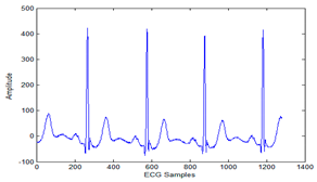 Sensors 20 02941 i001 Sensors 20 02941 i001