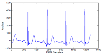 Sensors 20 02941 i005 Sensors 20 02941 i005