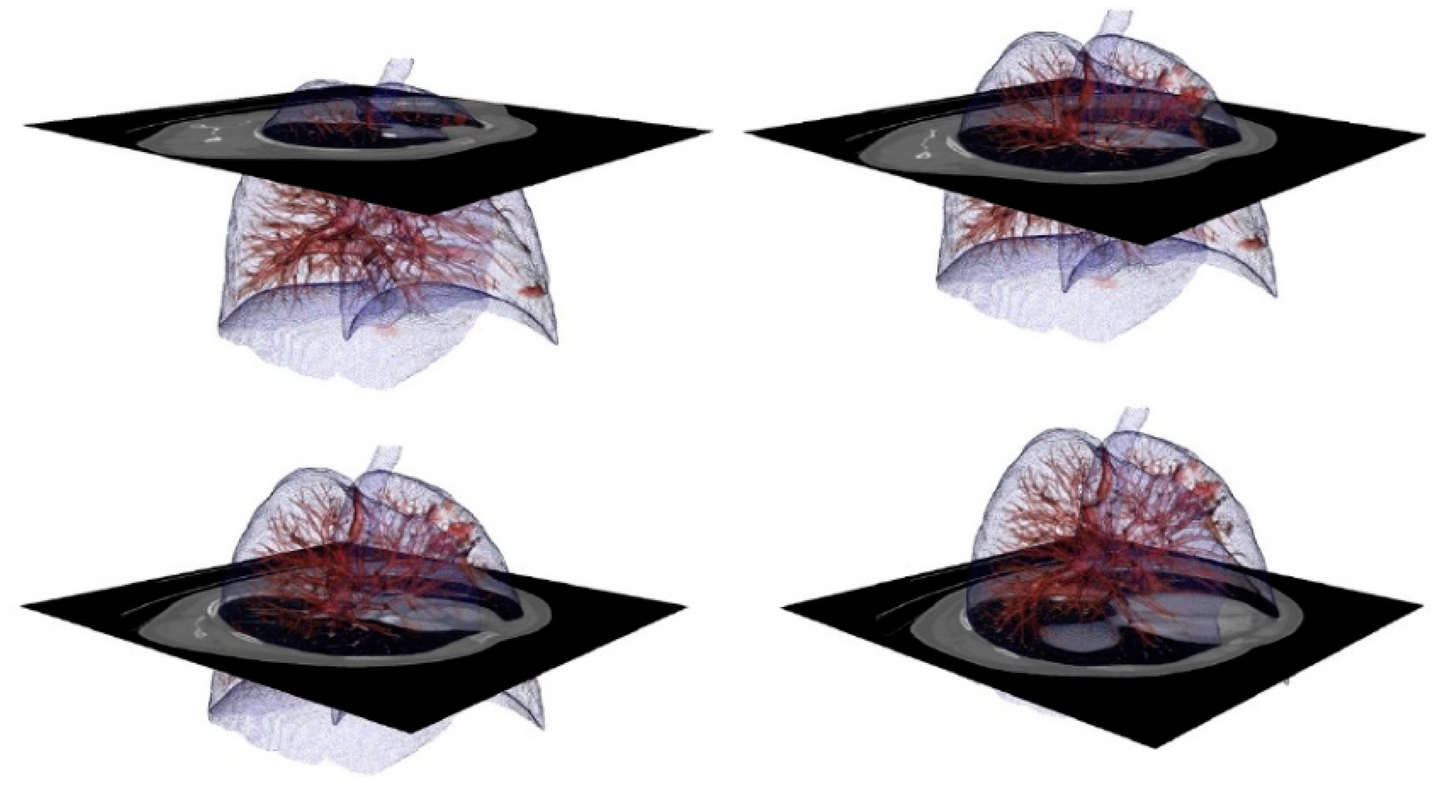 Sensors 20 02962 g002