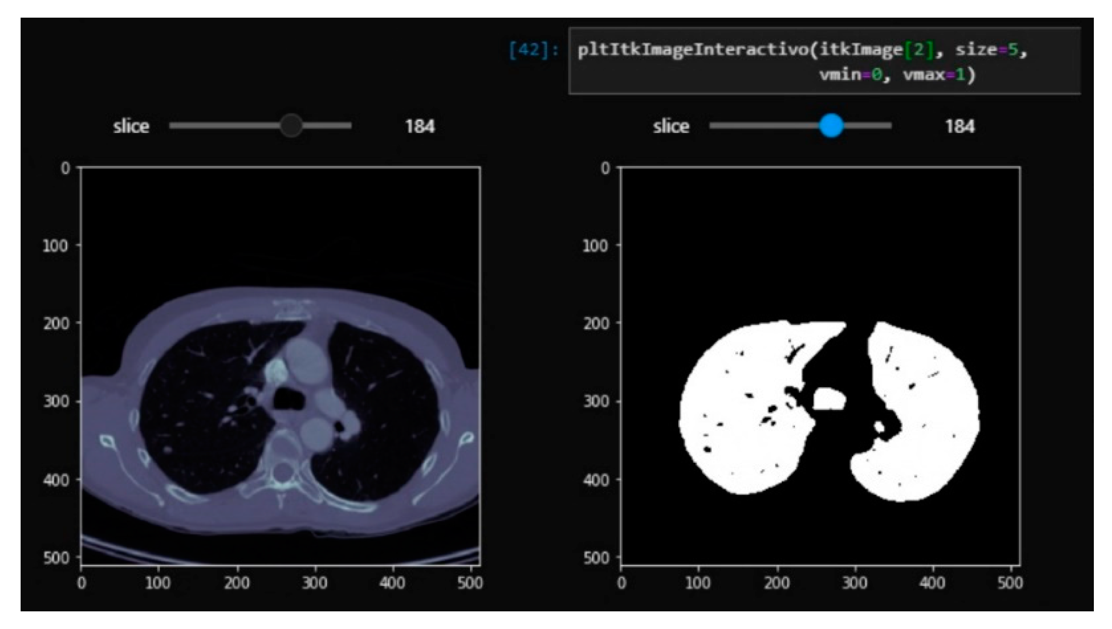 Sensors 20 02962 g003