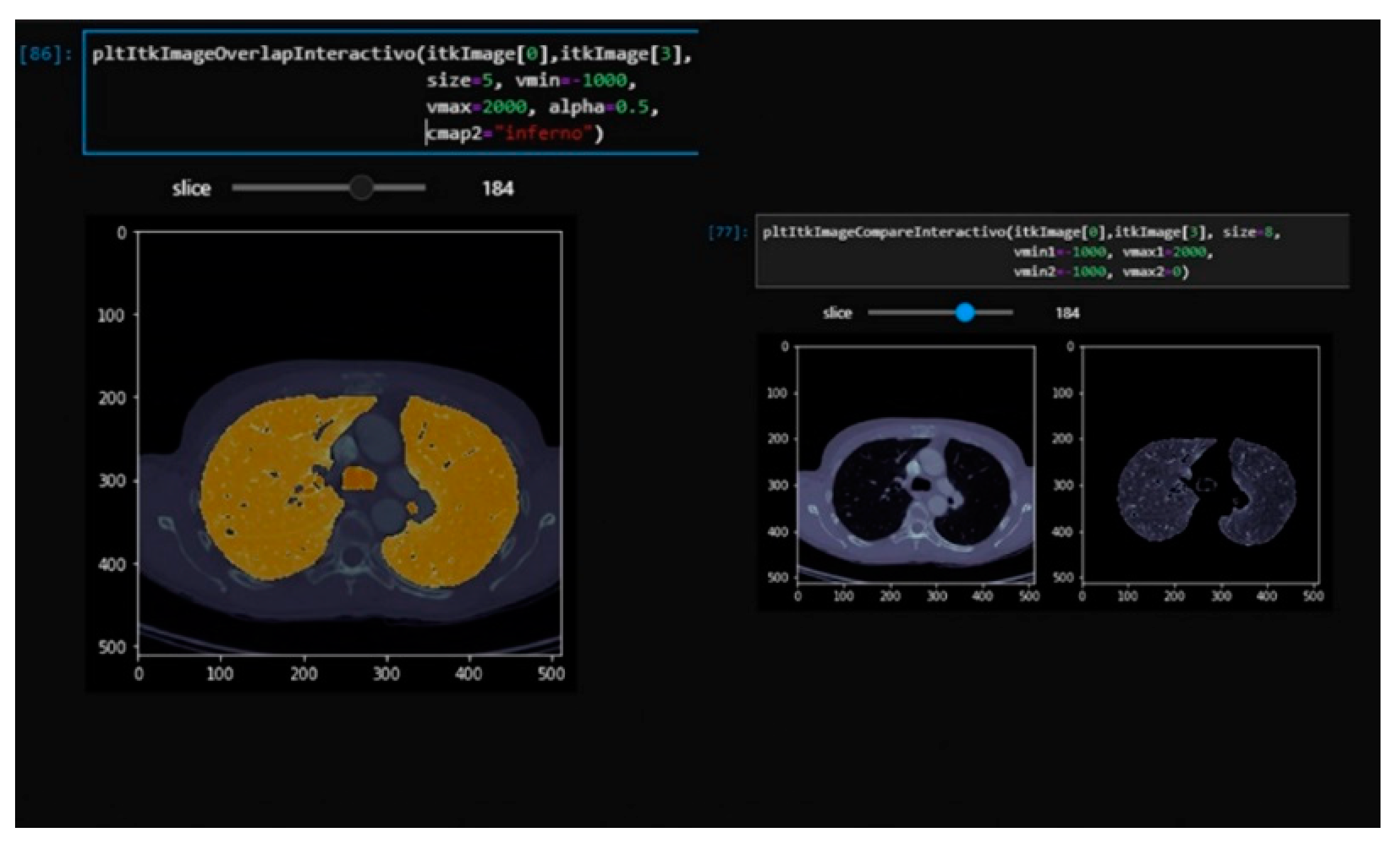 Sensors 20 02962 g004