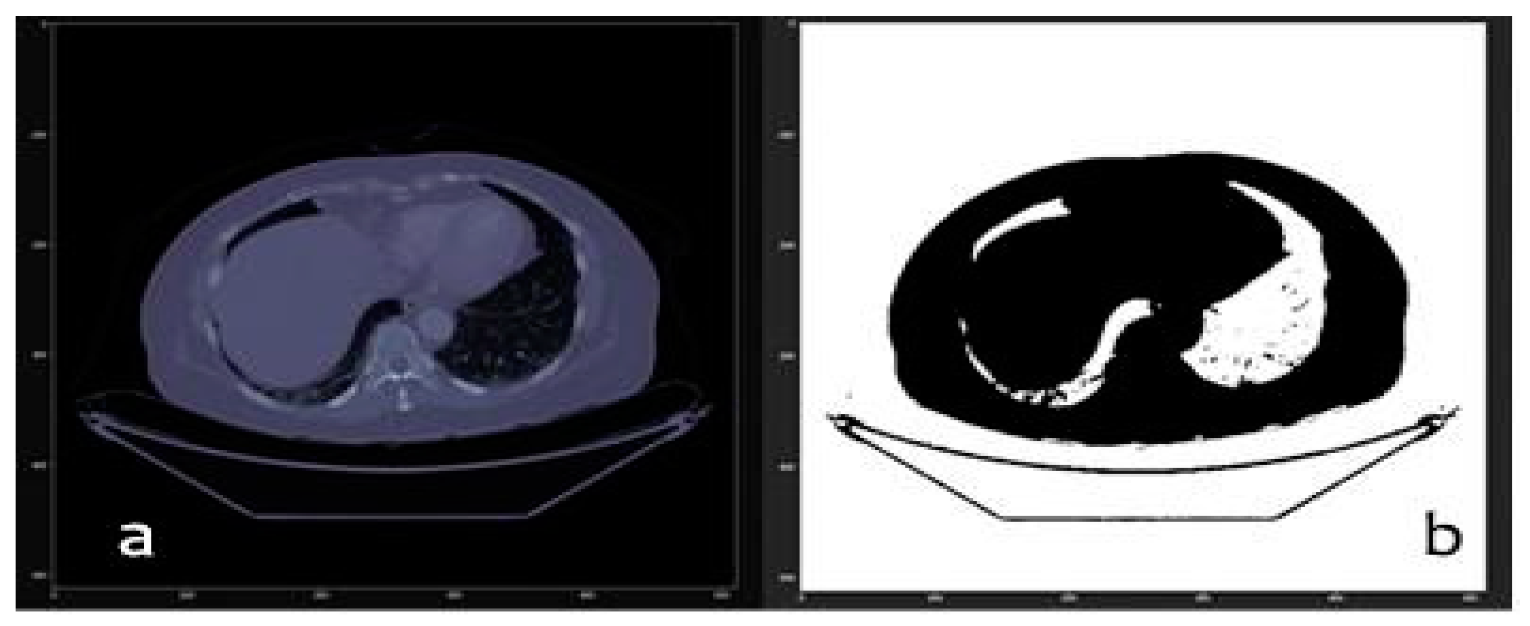 Sensors 20 02962 g006