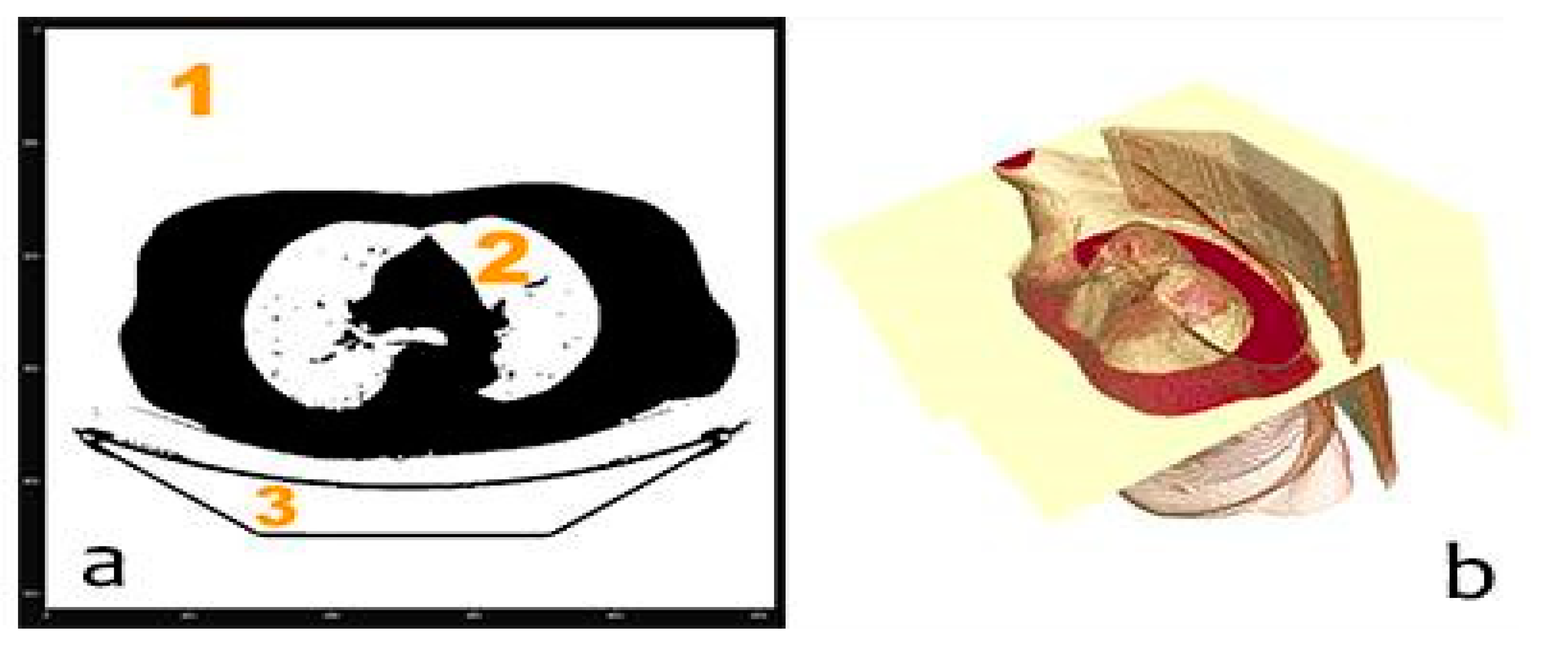 Sensors 20 02962 g007