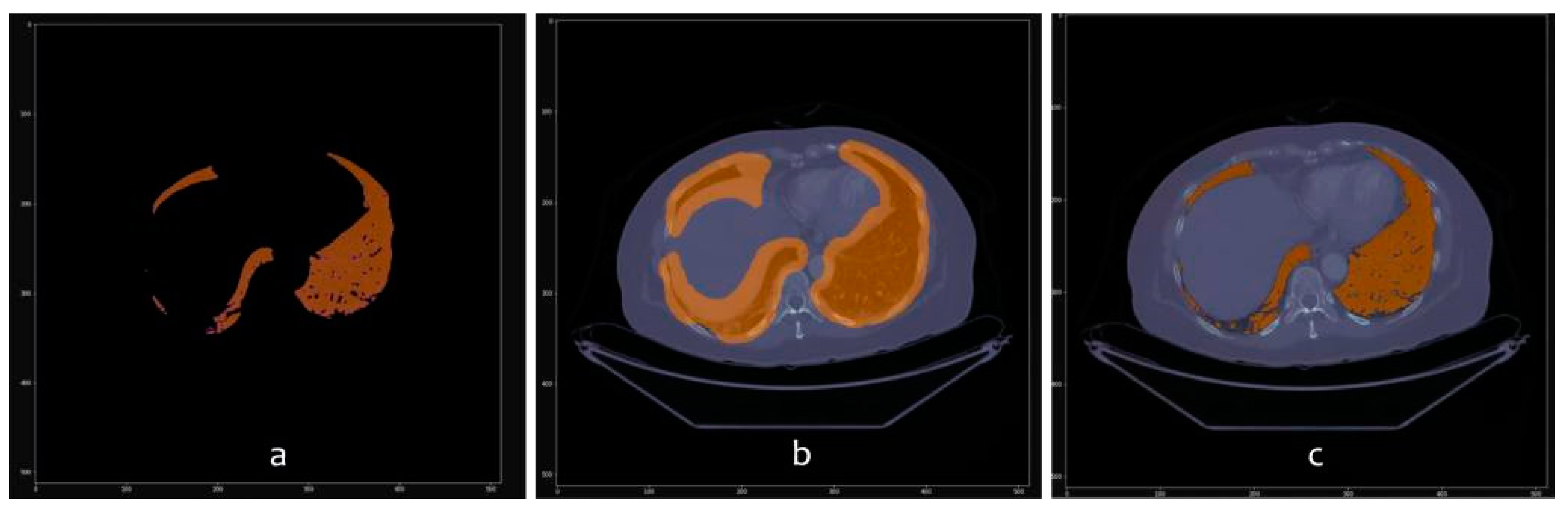 Sensors 20 02962 g009