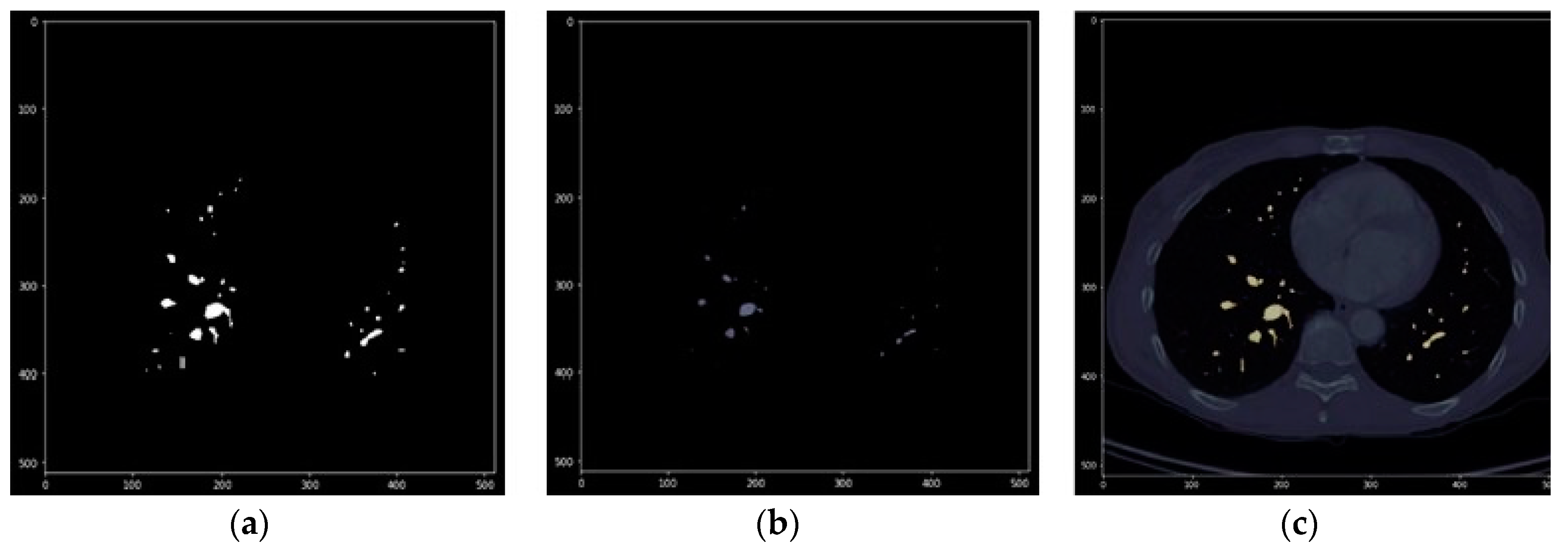 Sensors 20 02962 g012