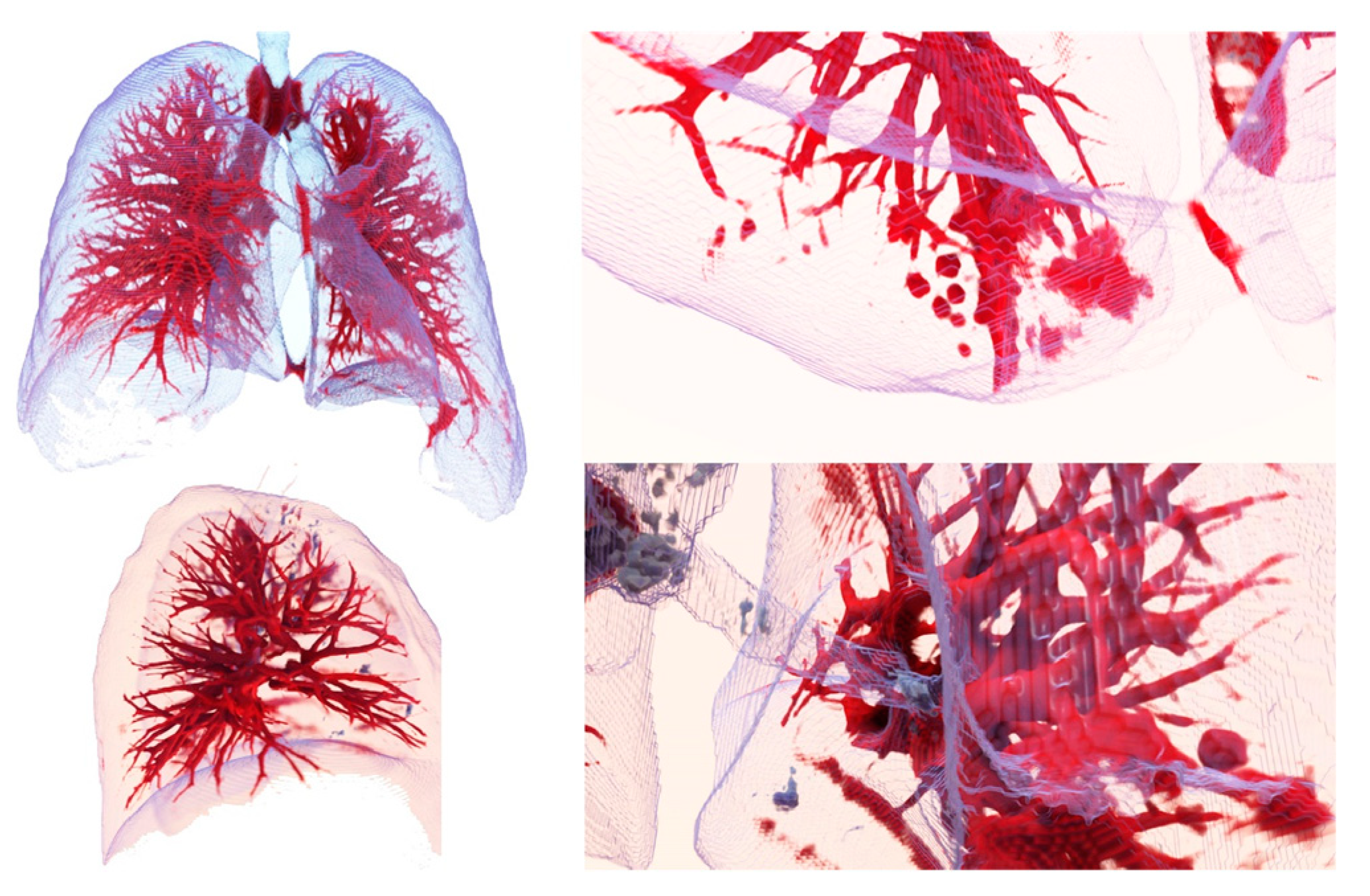 Sensors 20 02962 g013