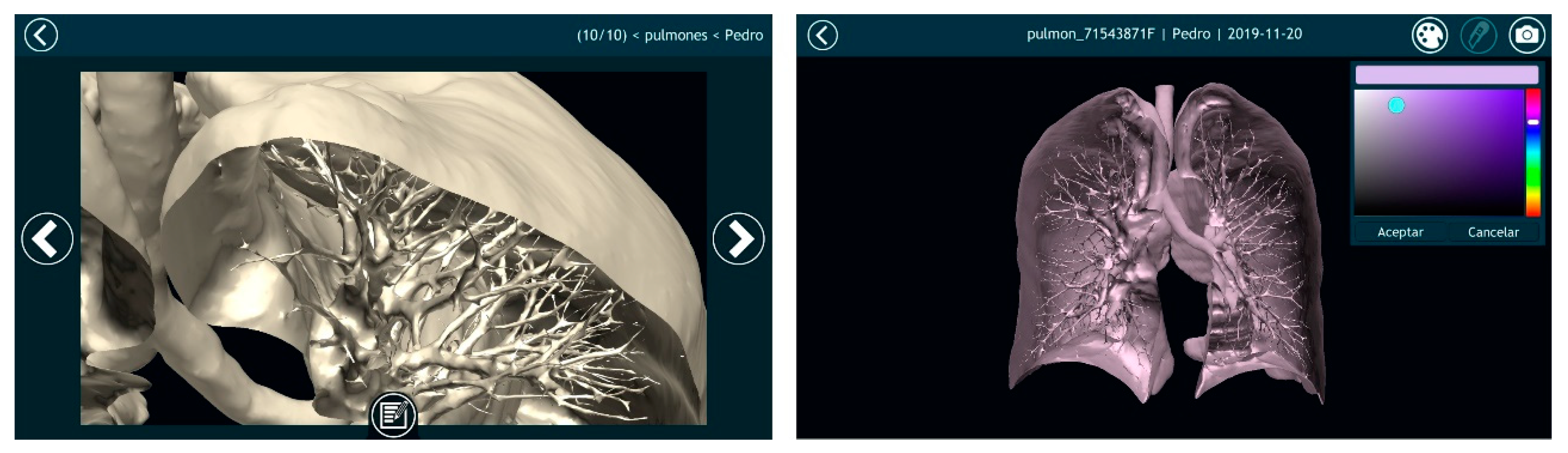 Sensors 20 02962 g015