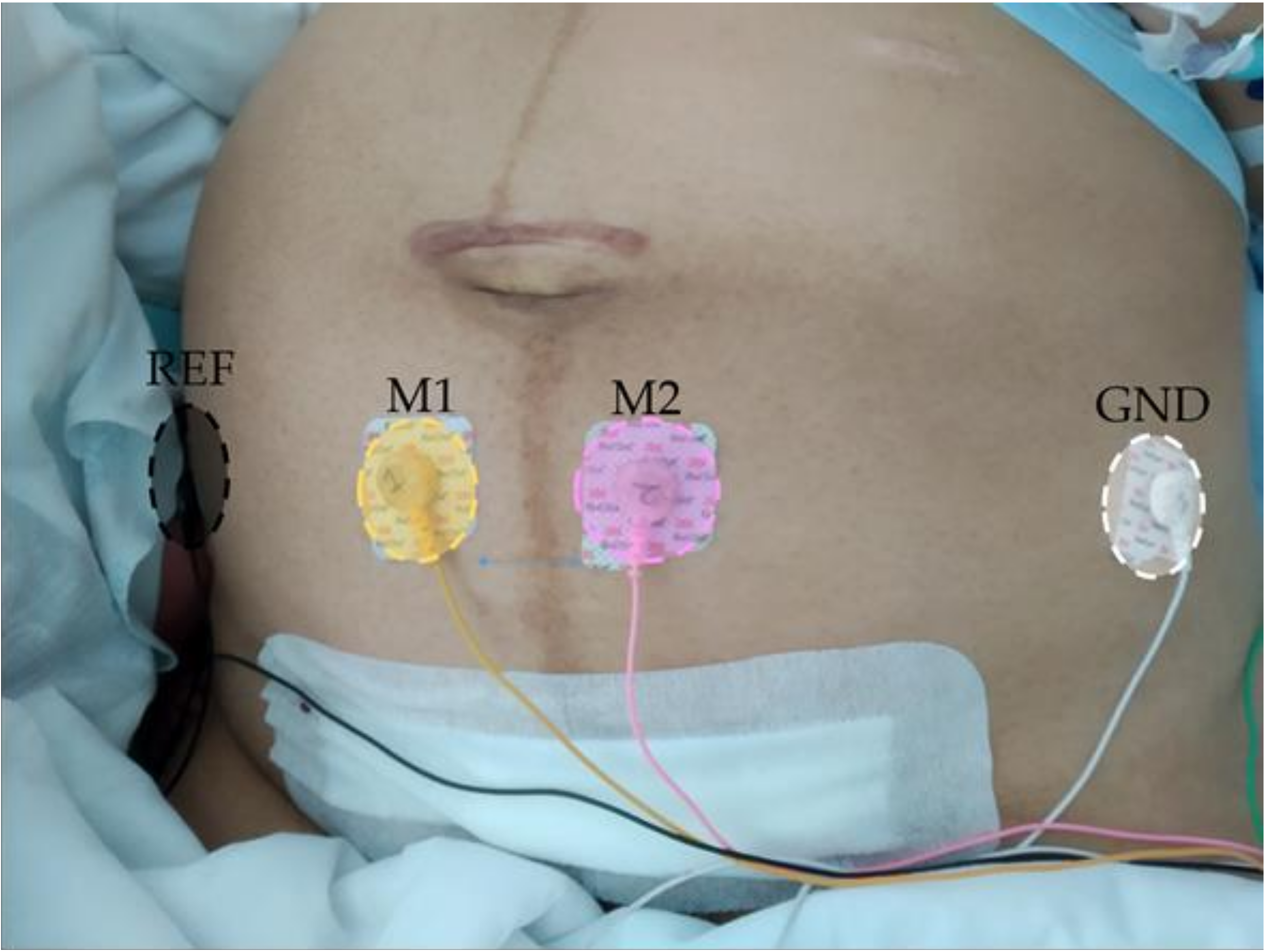 Sensors 20 03023 g001