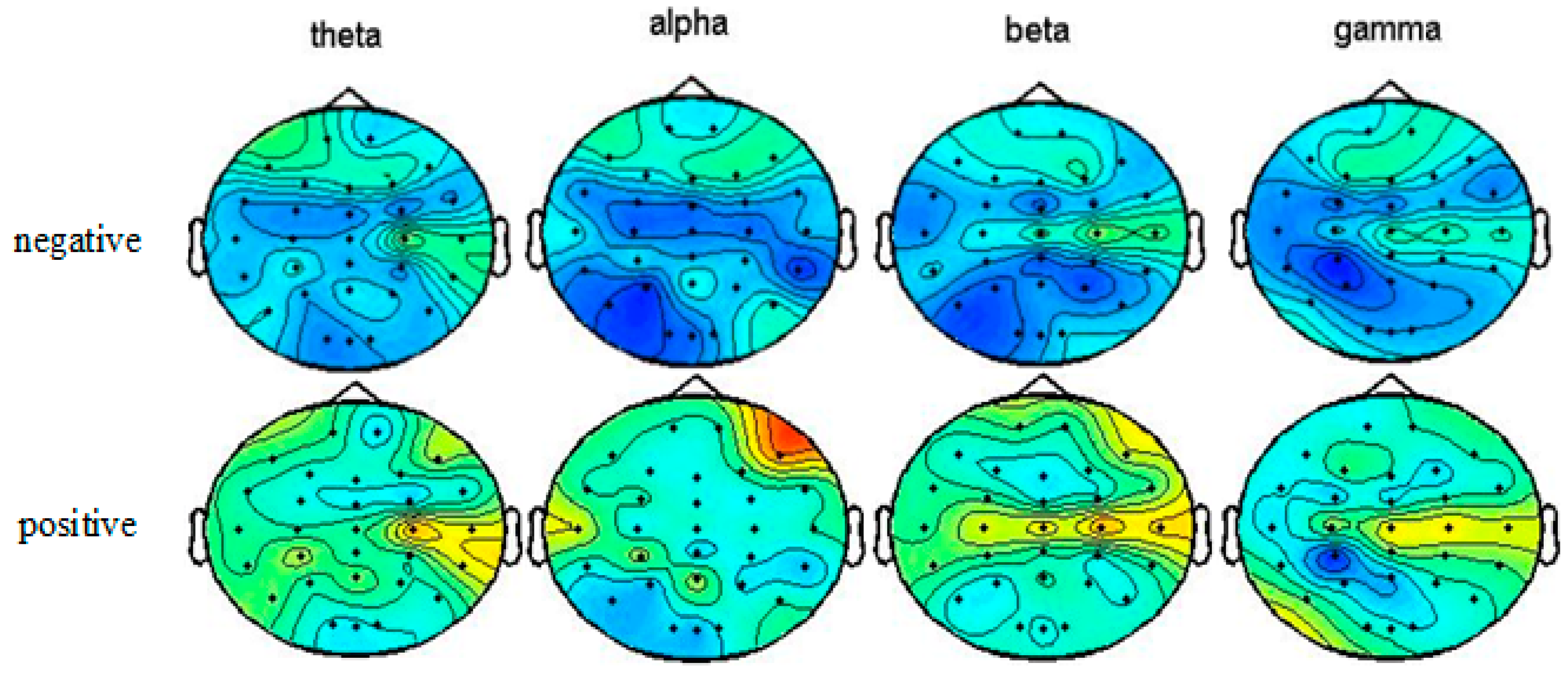 Sensors 20 03028 g005