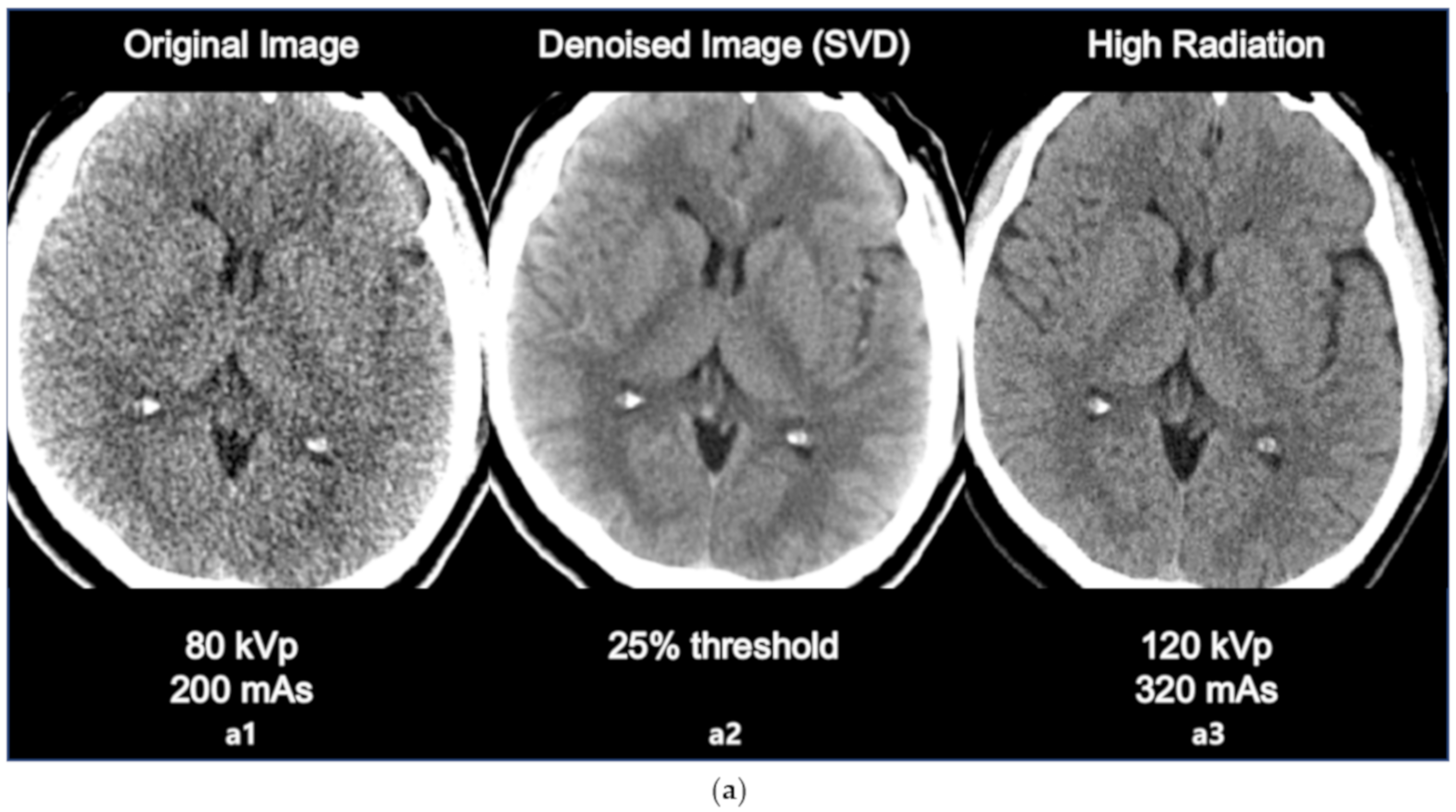 Sensors 20 03063 g004a