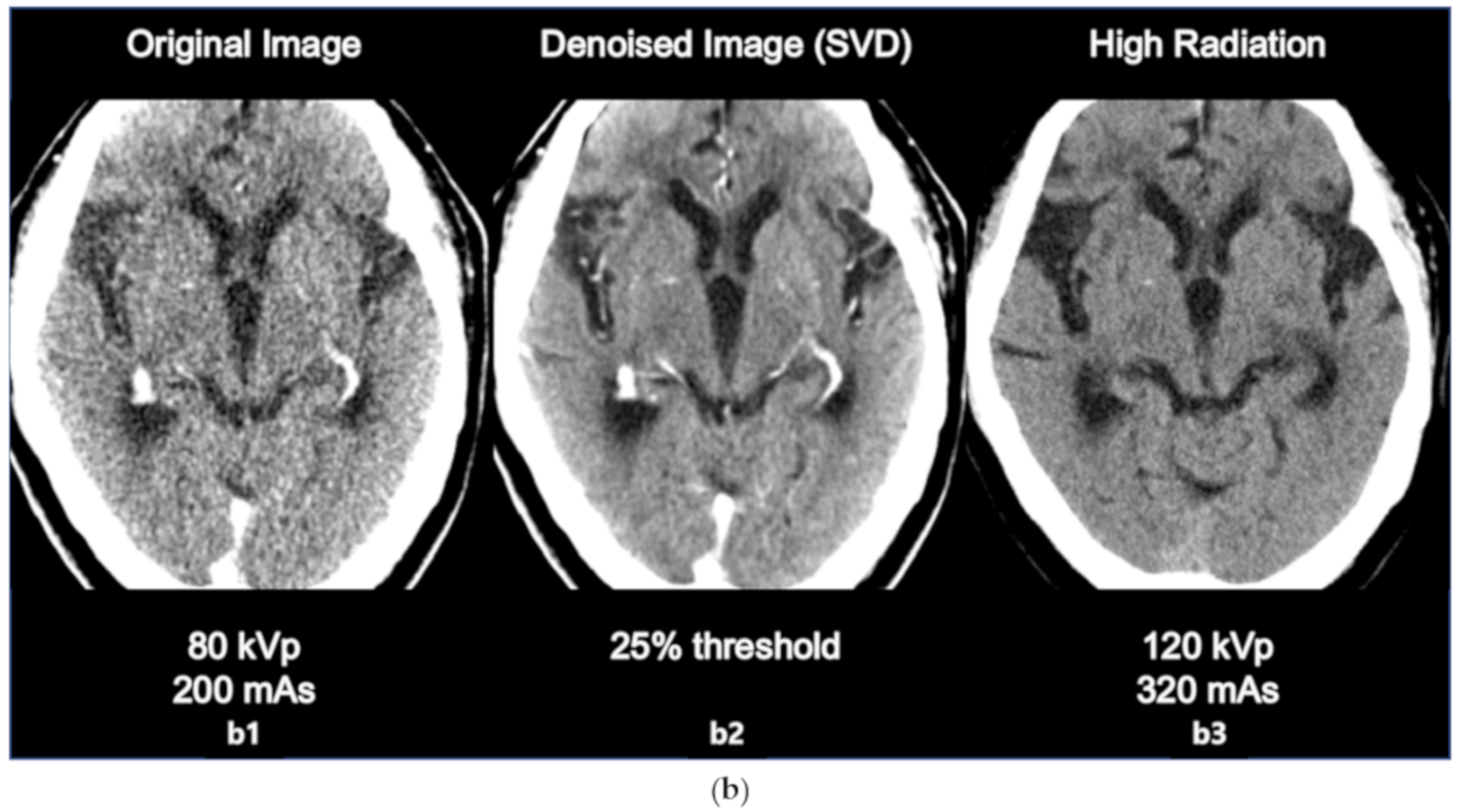 Sensors 20 03063 g004b