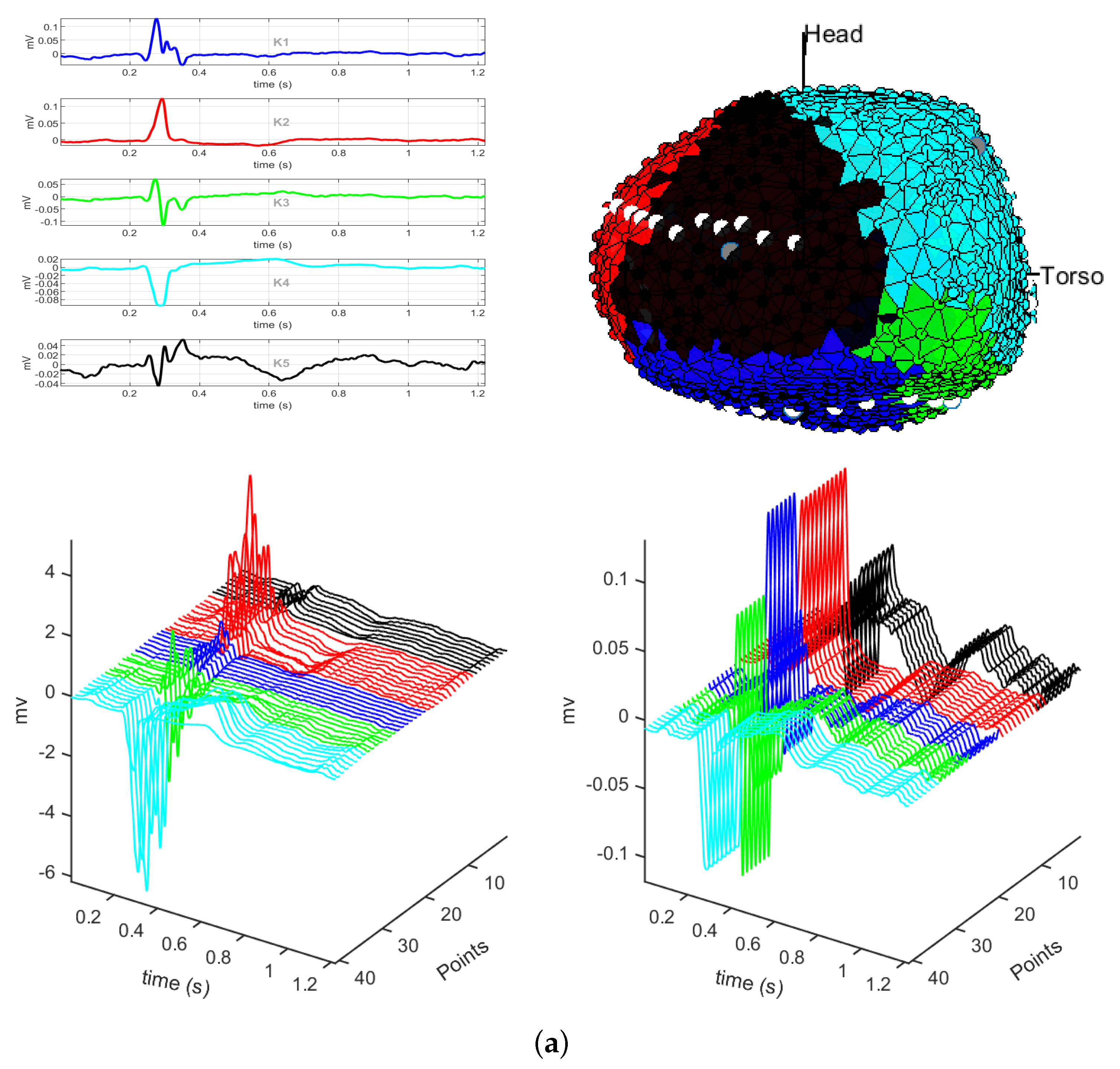 Sensors 20 03070 g003a