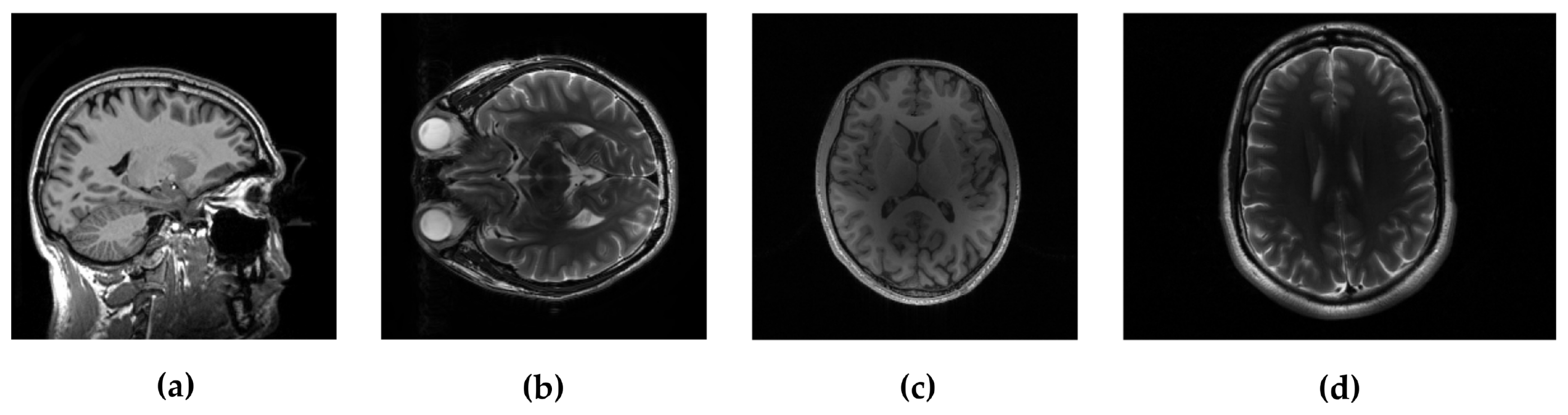 Sensors 20 03185 g002