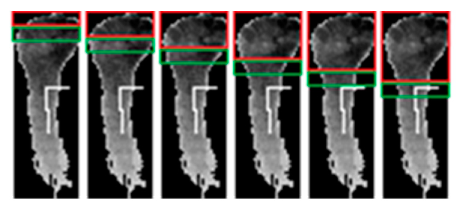 Sensors 20 03226 g006